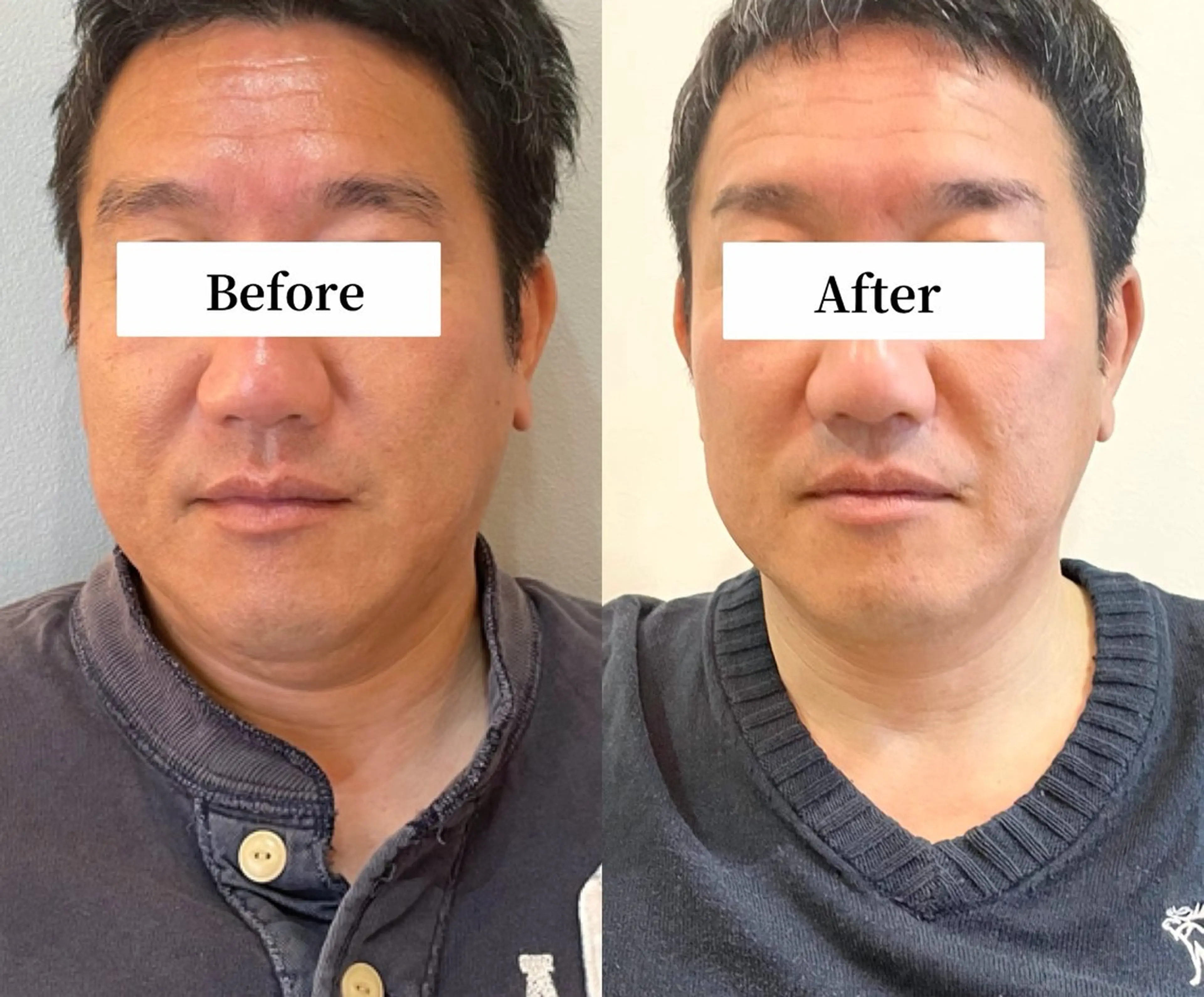 エステ リラク Private SalonOboraのエステ・リラクイメージ