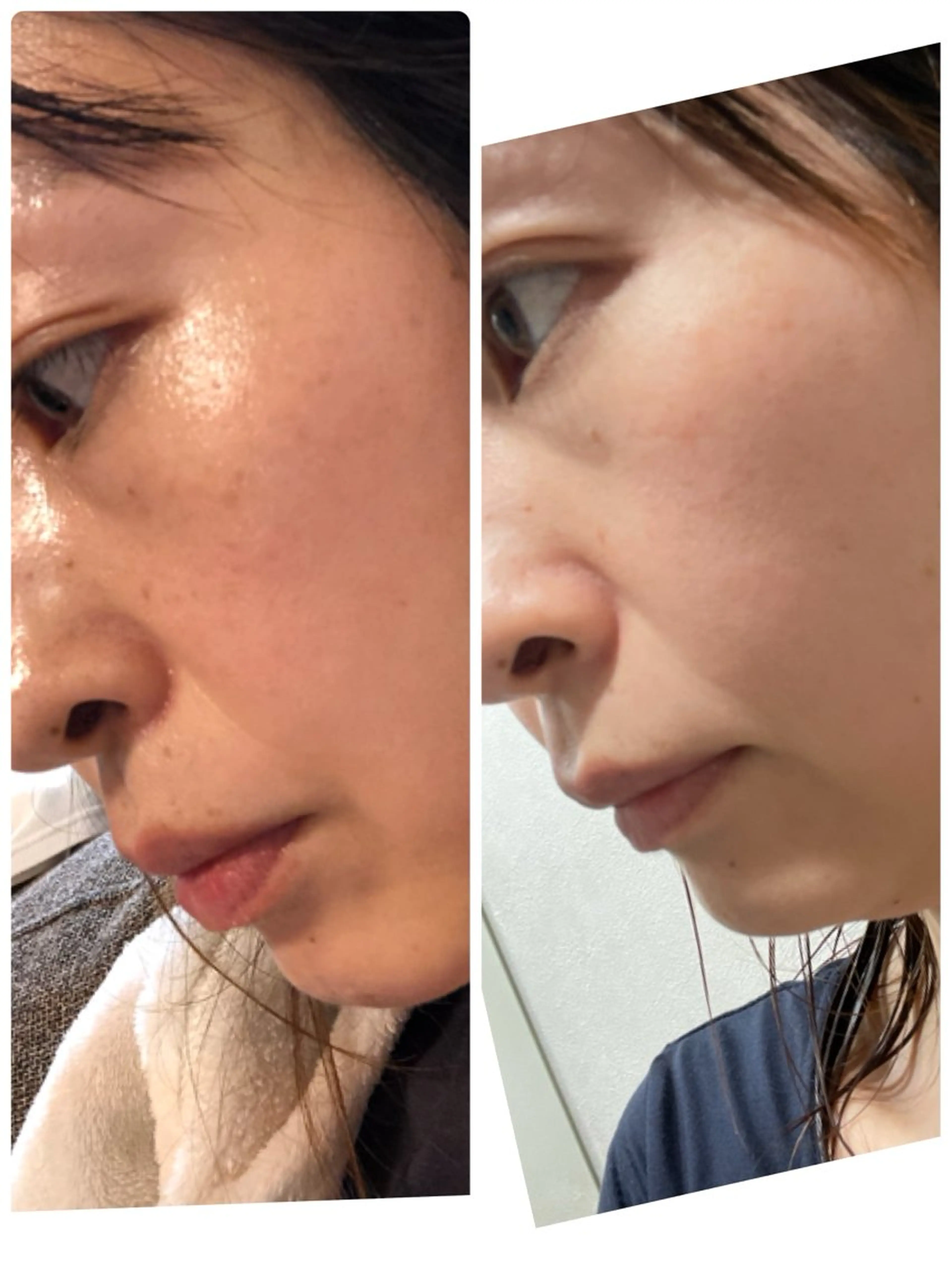 NARIS BEAUTY STATION　デ・アイム 長崎所属・立石 文香のエステ・リラクイメージ