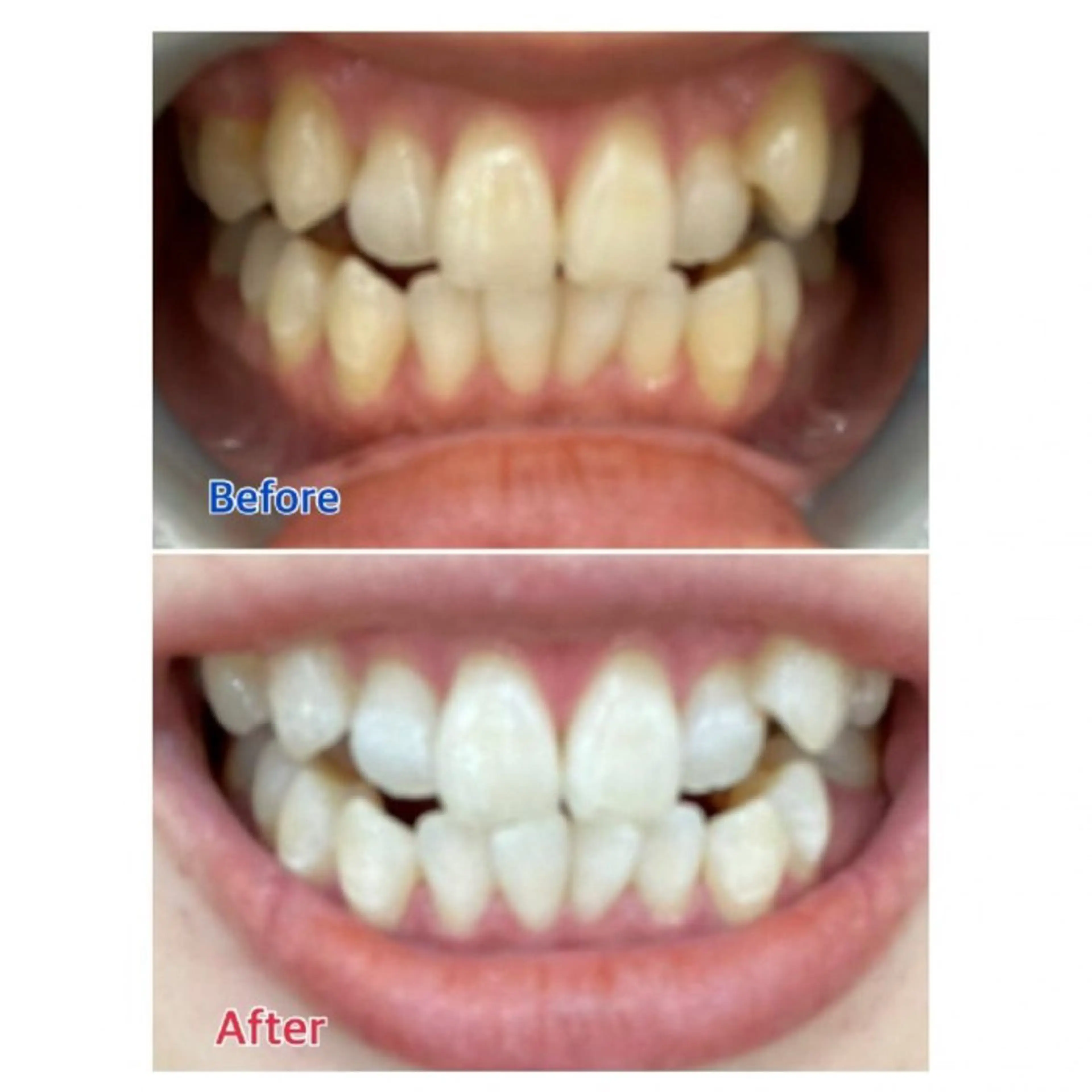 M渋谷店所属・Ｍ渋谷 ホワイトニングのエステ・リラクイメージ