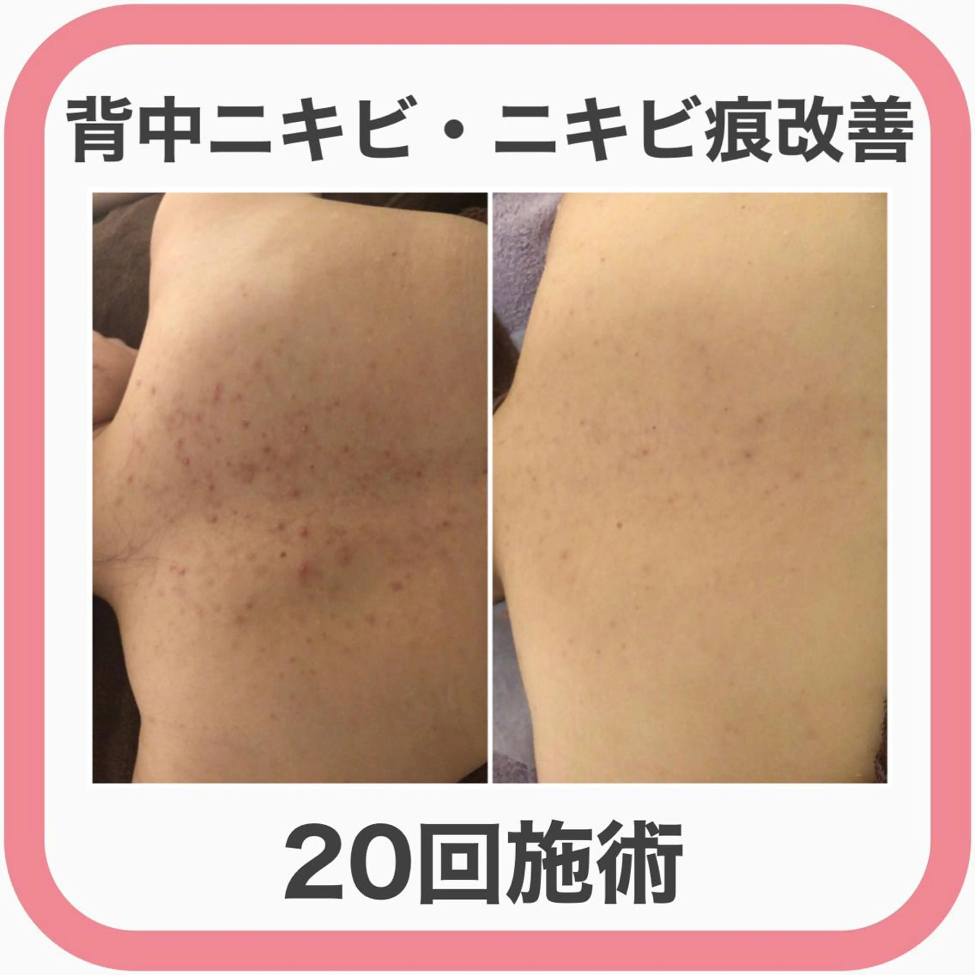 ミディアム カラー パーマ ヘアアレンジ メンズ キッズ ネイル マツエク・マツパ エステ リラク ニキビ・肌質改善専門 ♡人生が変わるサロンのエステ・リラクイメージ