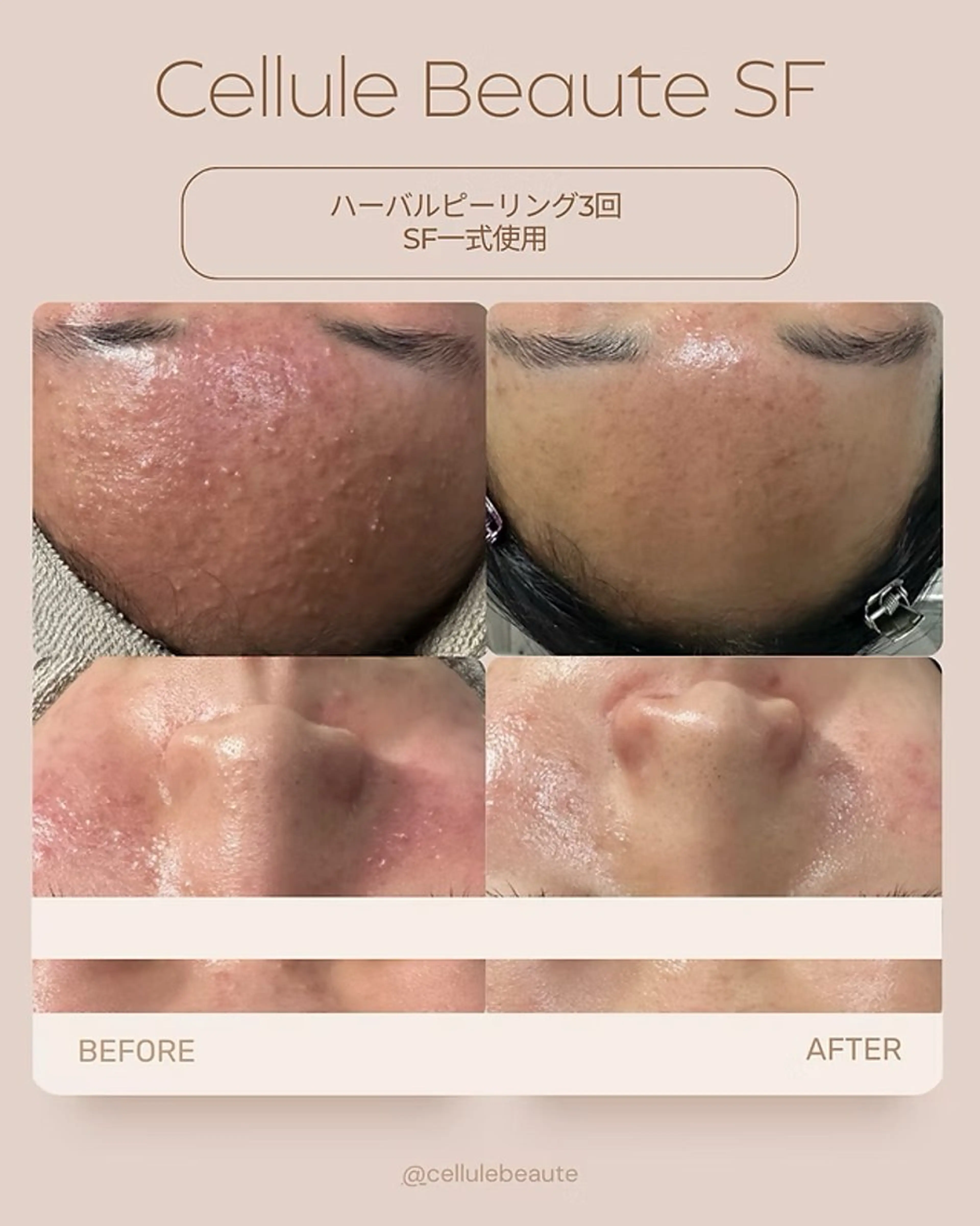 エステ スキンケアサロン　デディア所属・米谷🎀 デディア恵比寿🪞✨のエステ・リラクイメージ