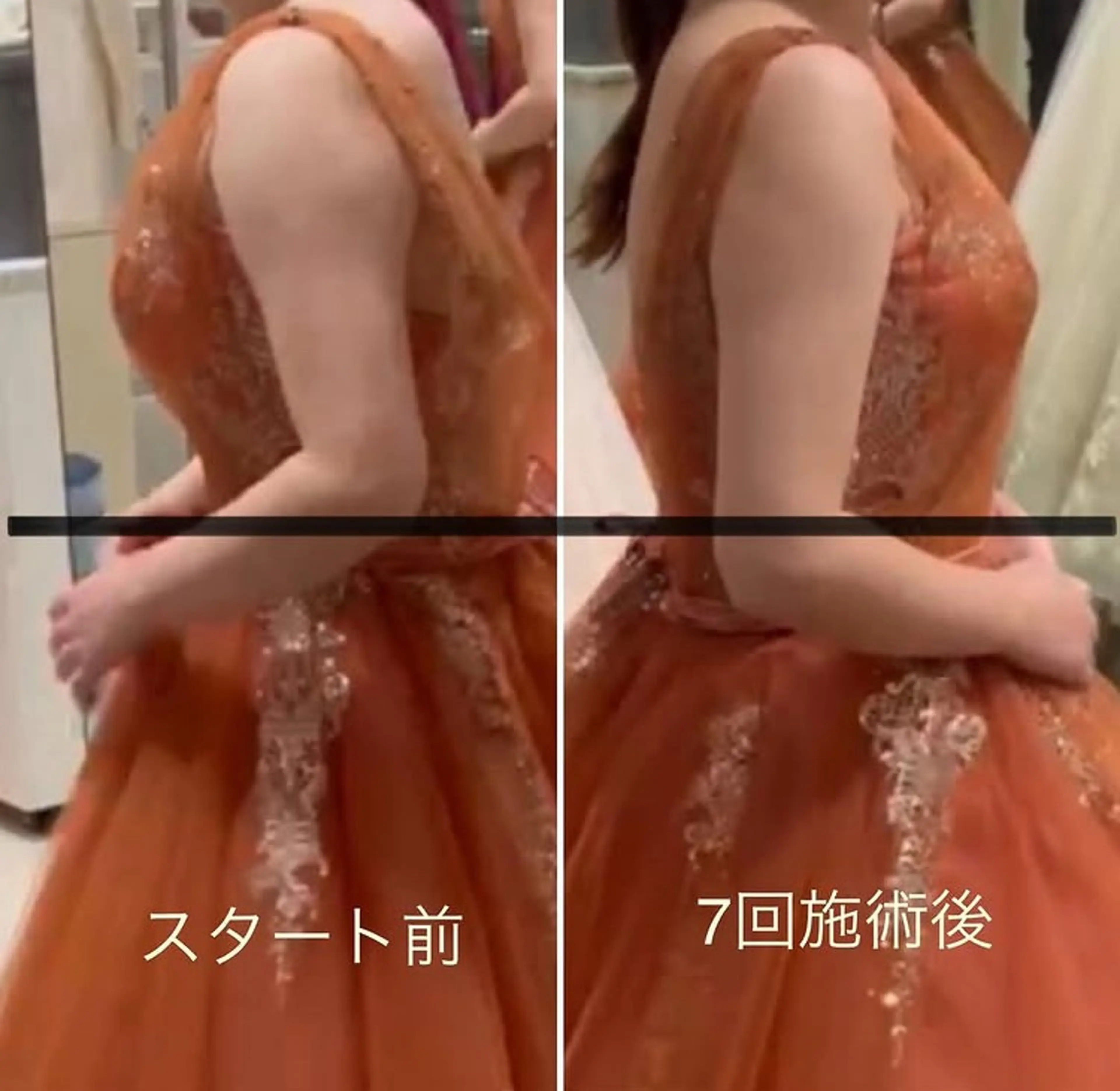 エステ リラク アイリー サロンのエステ・リラクイメージ