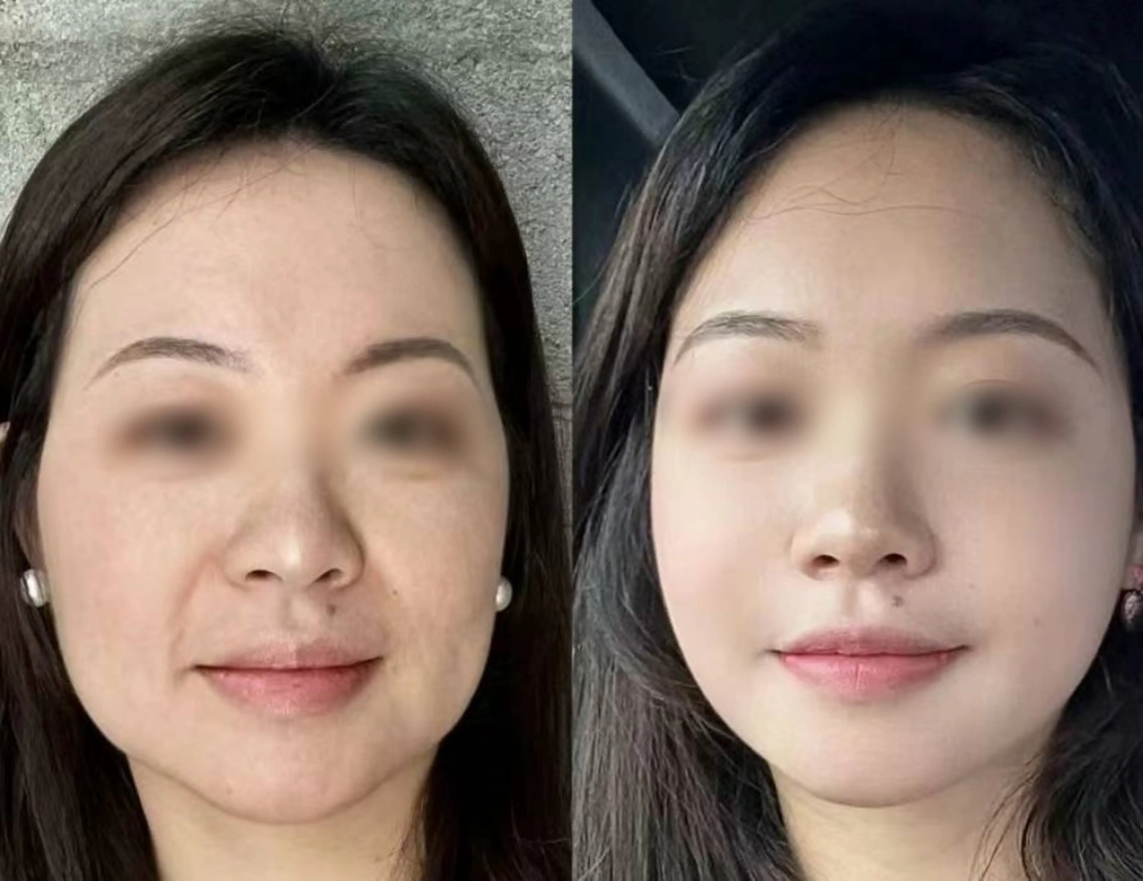 アイブロウ 眉毛ワックス脱毛 aliaハイフ&水光ジェットサロン所属・aliaハーブ水光店 エステティシャン募集のエステ・リラクイメージ