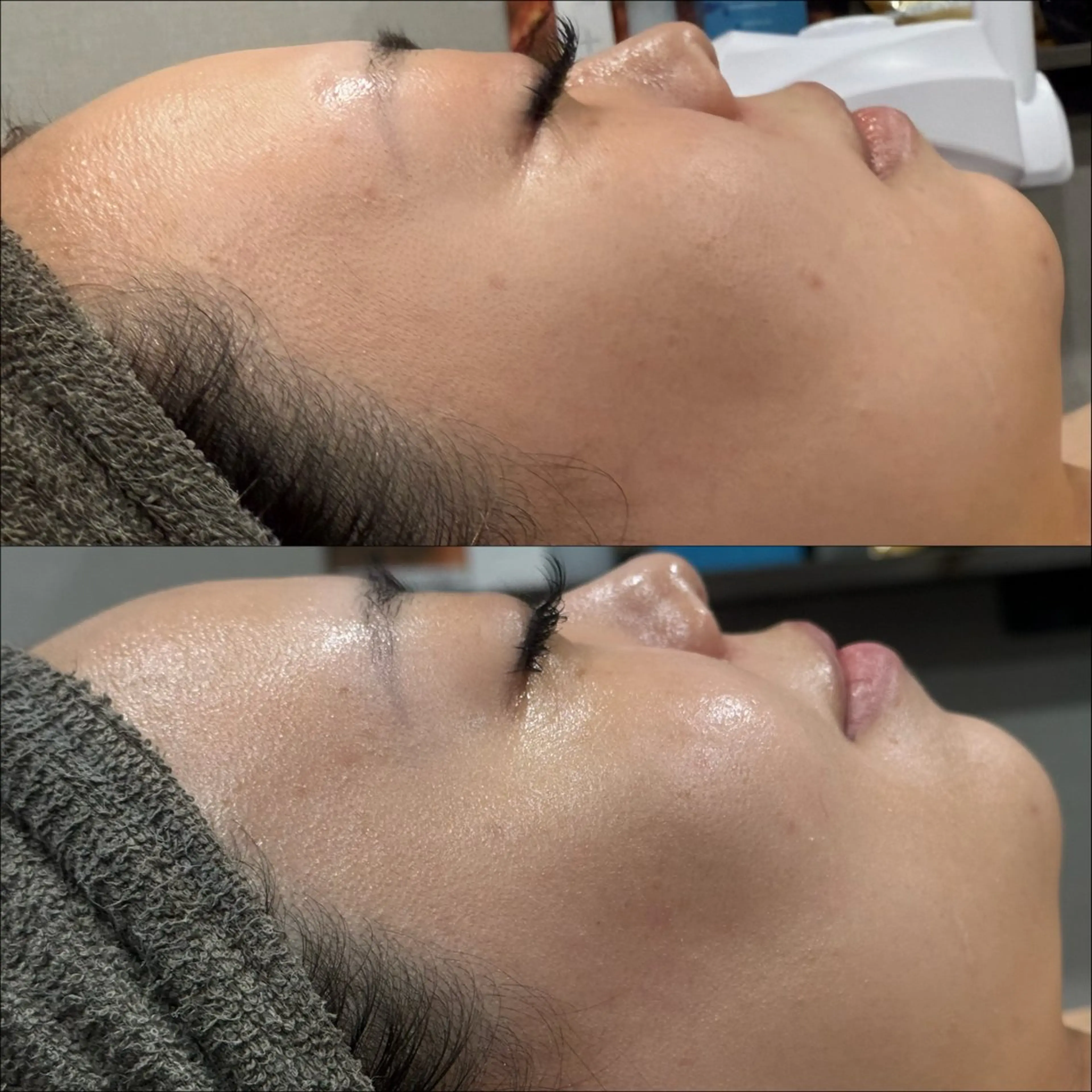 エステ LiZA エステティックサロンのエステ・リラクイメージ