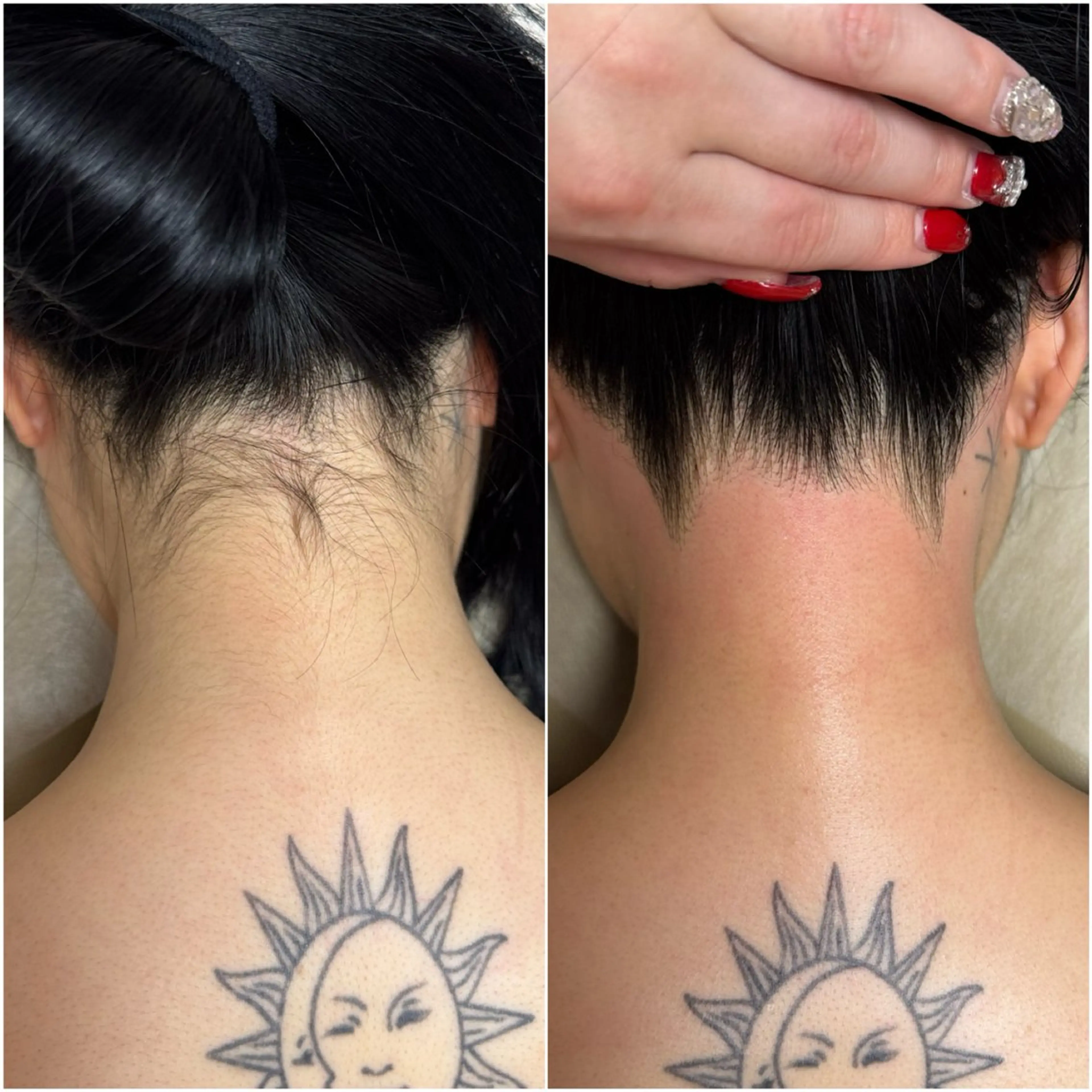 脱毛 毛穴レス ハーブ& ワックス脱毛×光脱毛のエステ・リラクイメージ