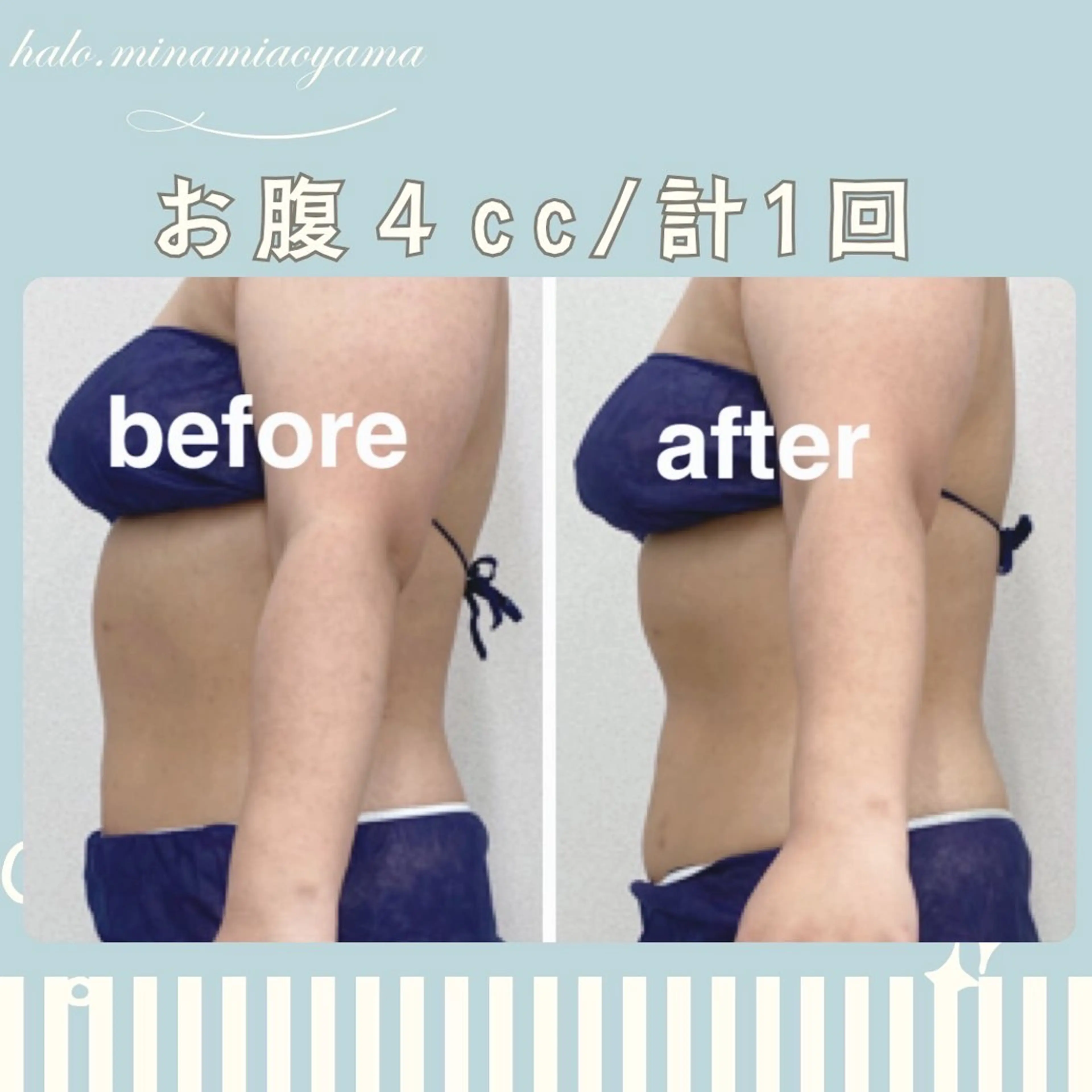 エステ 小顔痩身HALO 二宮早織のエステ・リラクイメージ