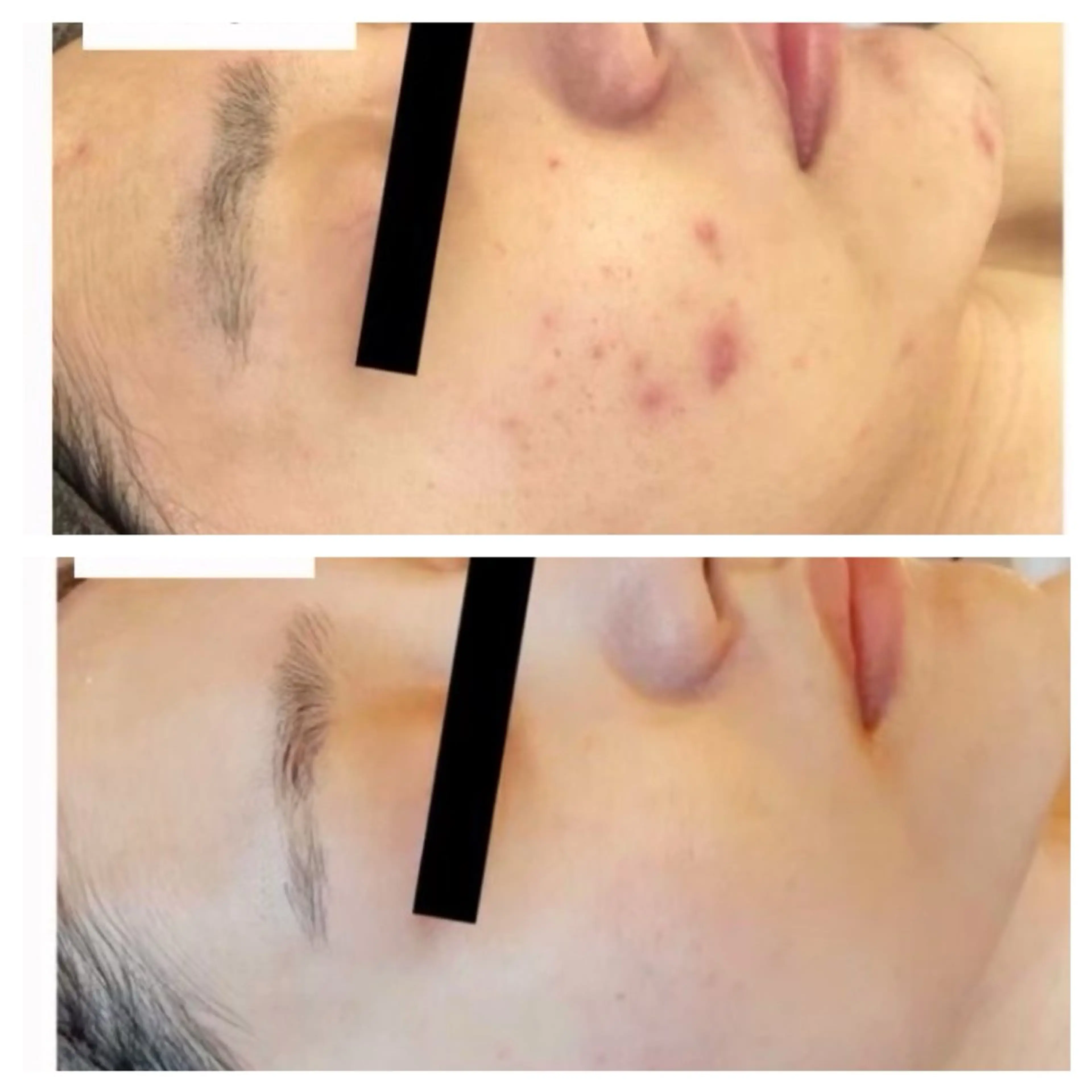 【初回限定】オルちゃん肌に憧れる方へ！目指せ陶器肌プログラム体験の写真