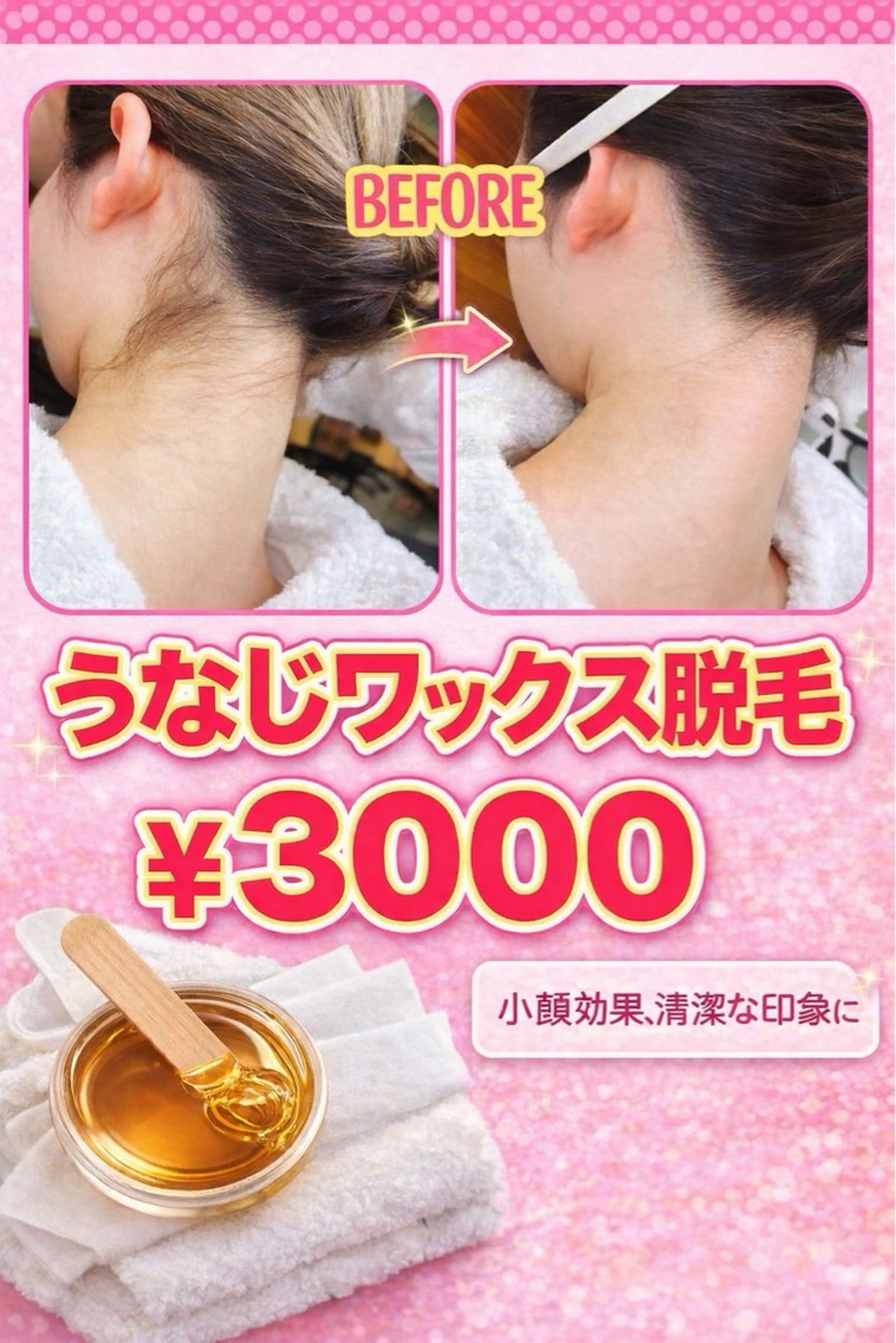 エミルカ　自由が丘店所属・ニキビ・ニキビ跡🌿 ハーブピーリング✨のエステ・リラクイメージ