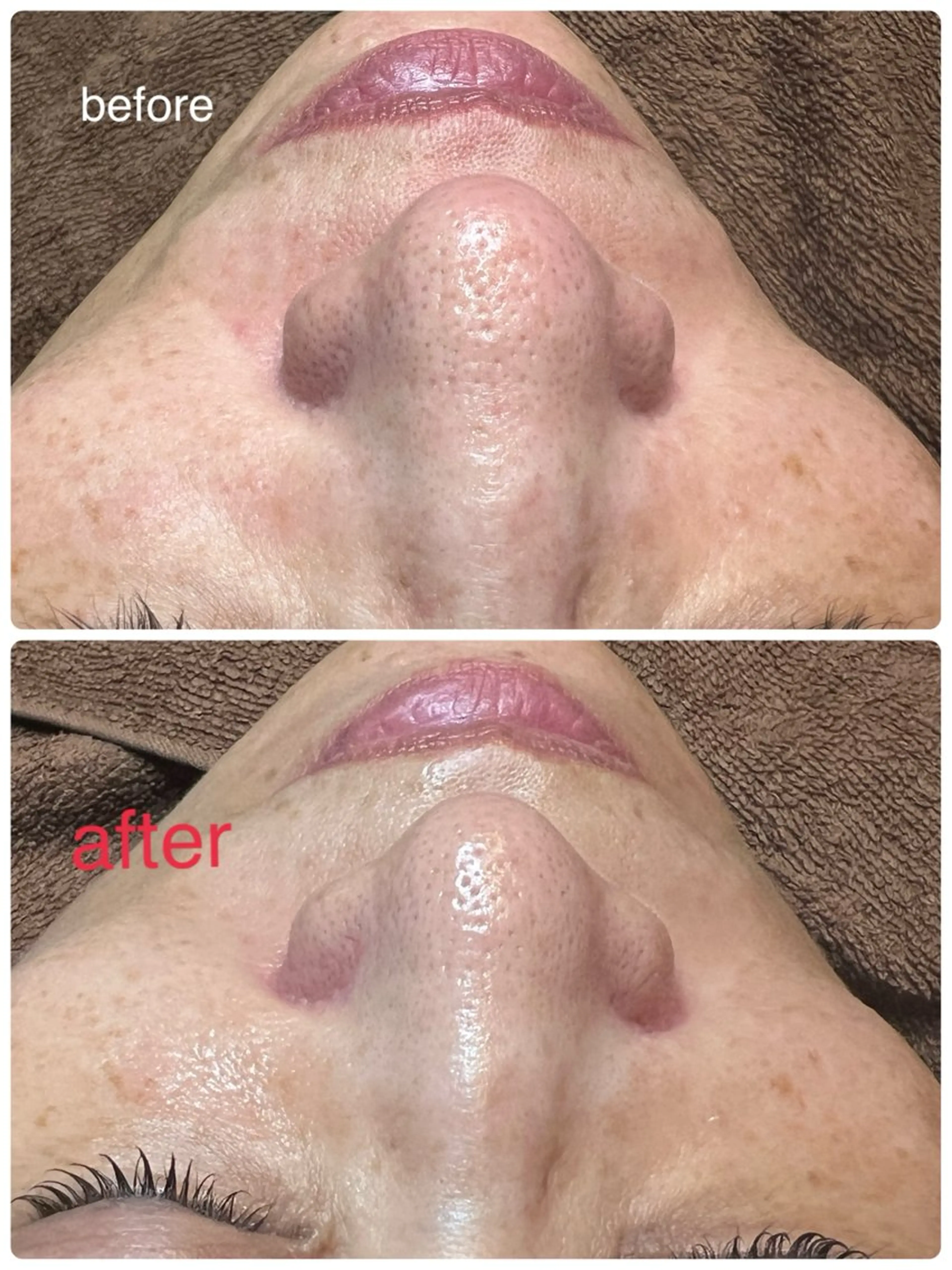 毛穴小顔・痩身サロン メイク・ド・ミュウのその他イメージ