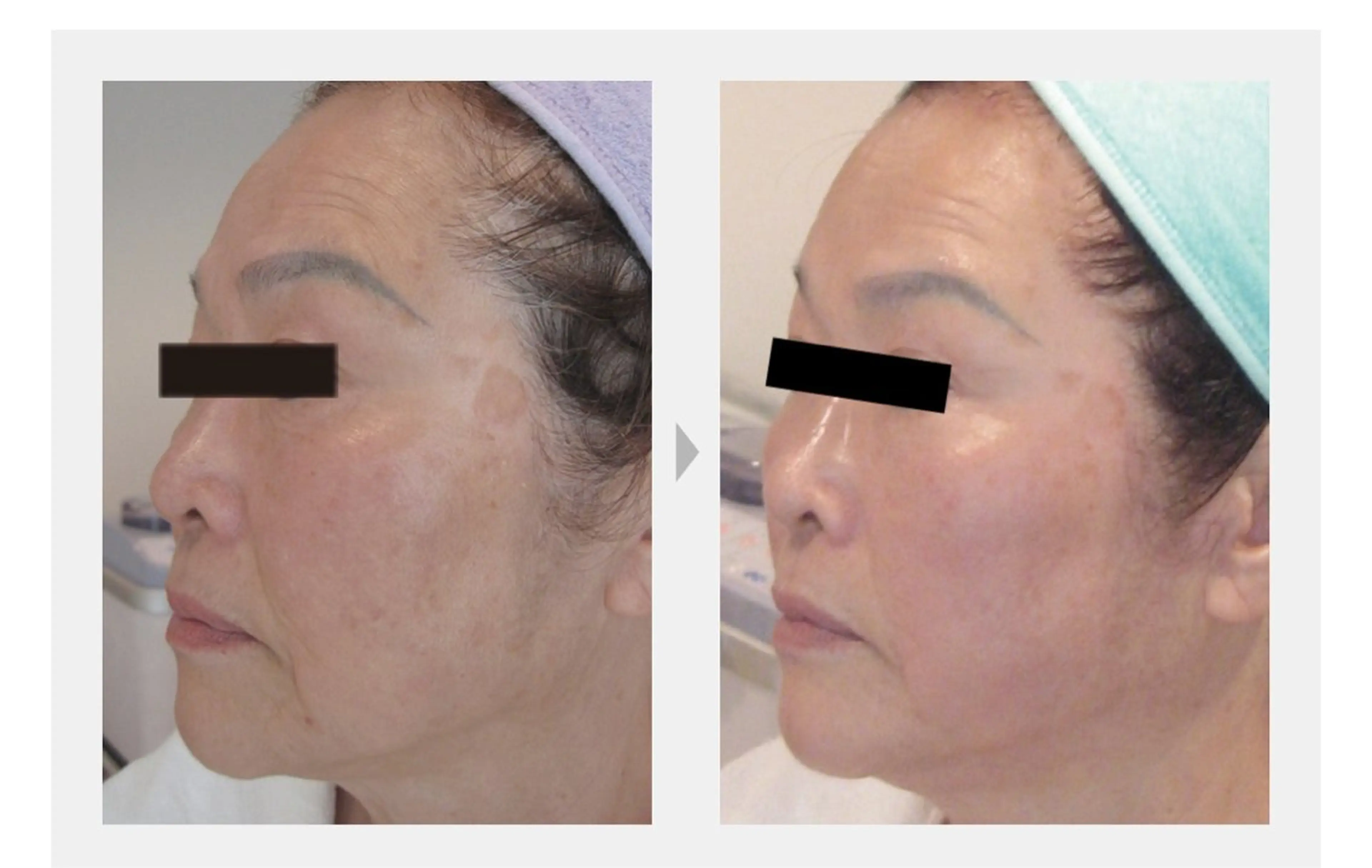 M. lisyelのエステ・リラクイメージ