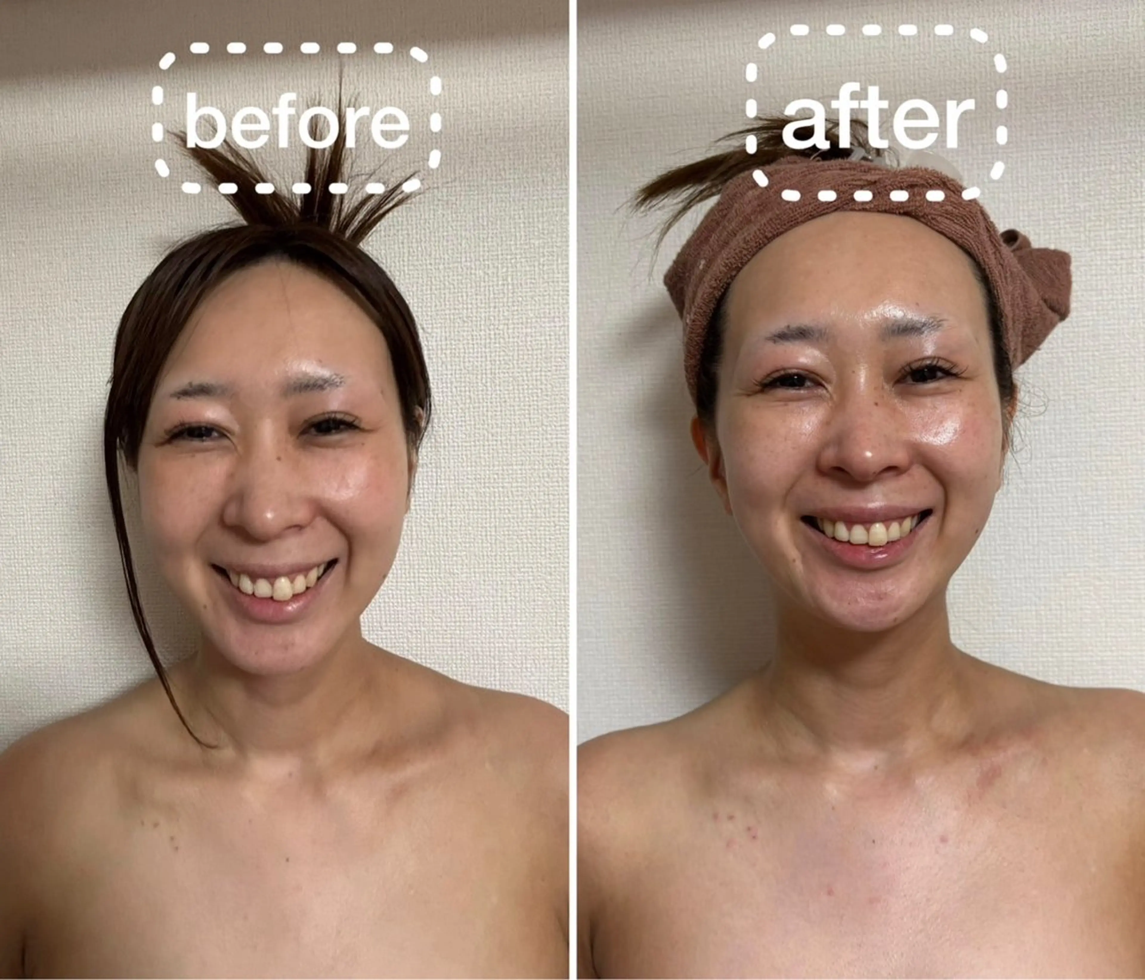 小顔&デコルテ&クビ&背中♥(ヘッドマッサージ付き) お化粧落としません セルキュア4t+EMS機能* 施術60分の写真