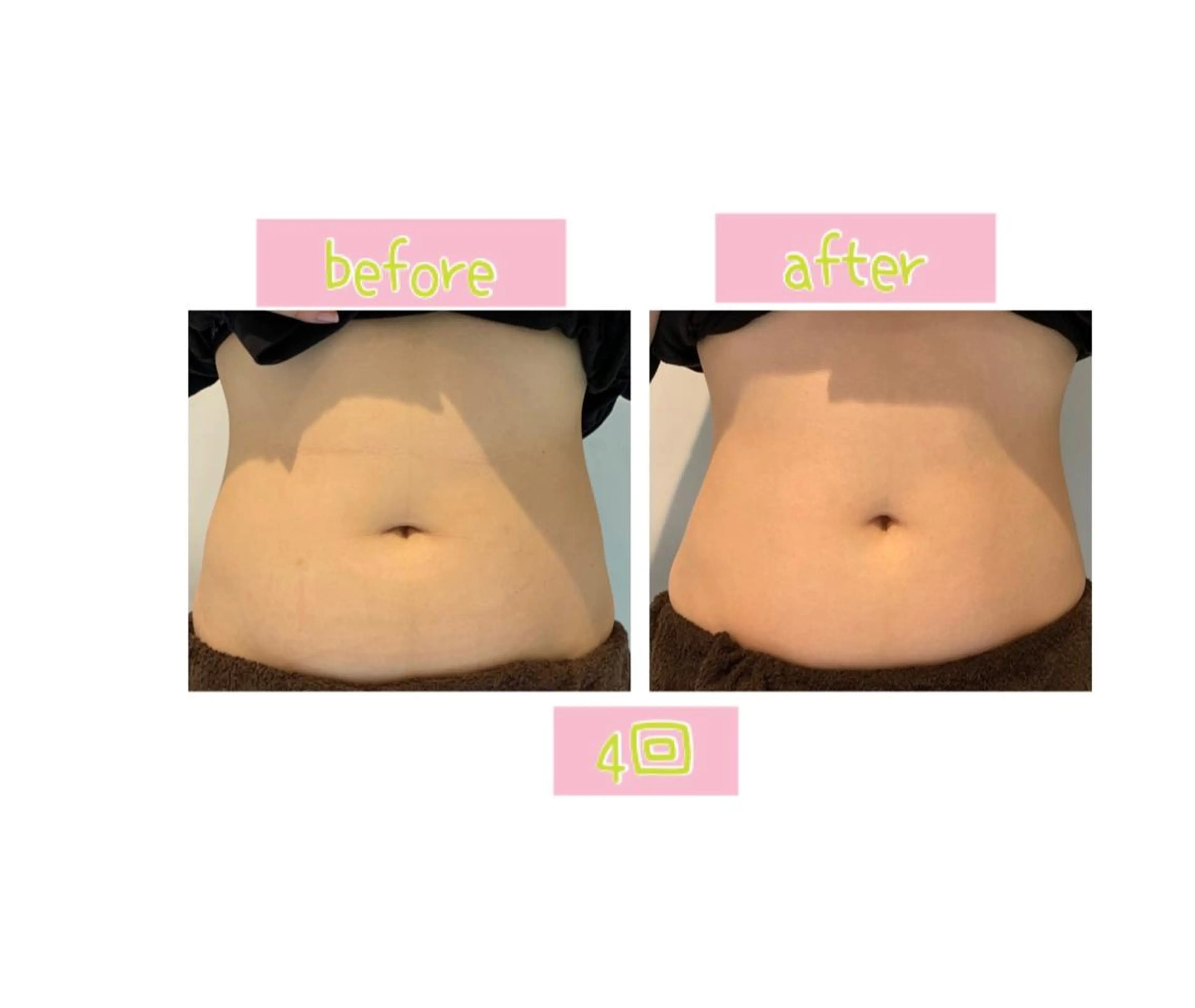 メンズ エステ 癒し腸もみサロン シャユーム　ゆきなのエステ・リラクイメージ