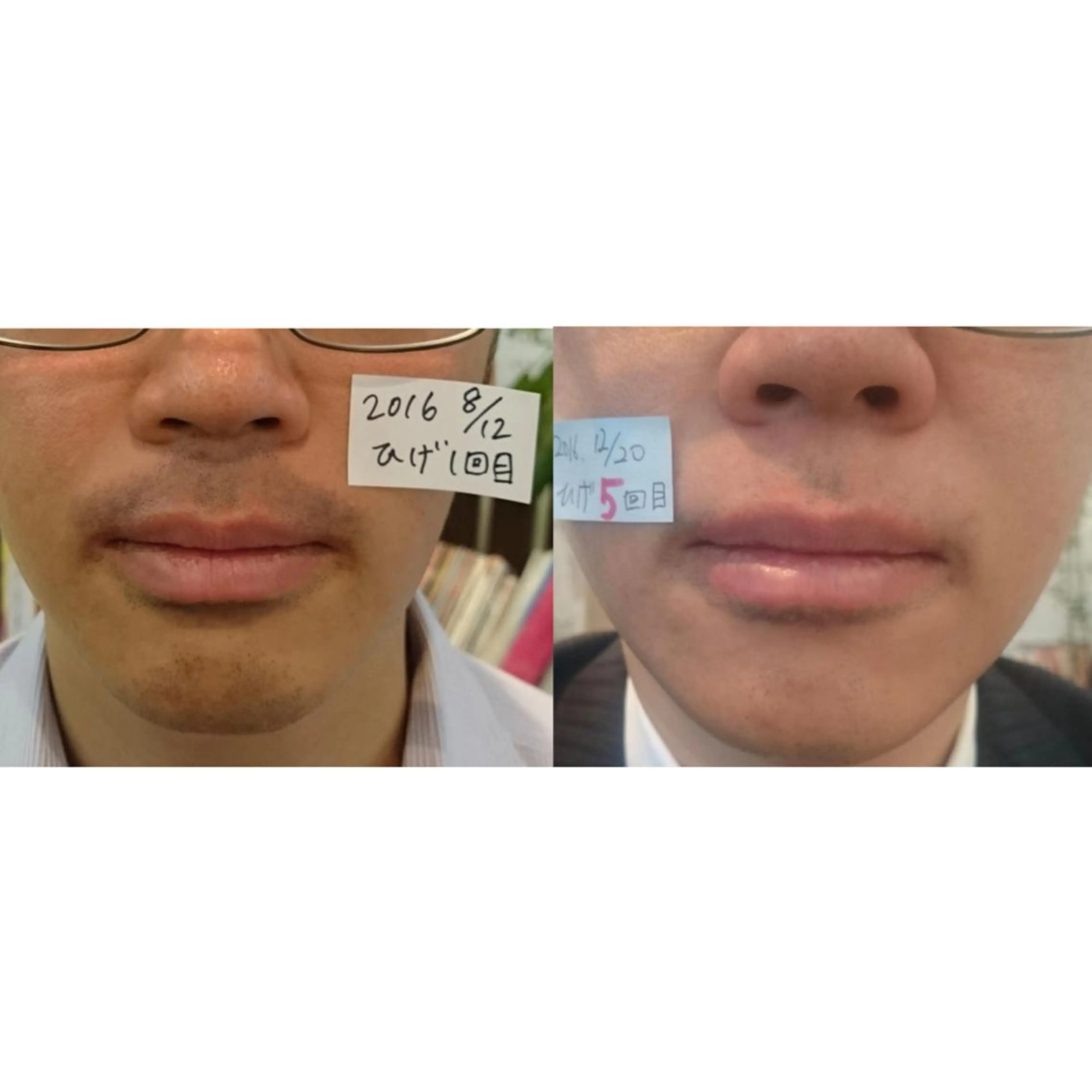 脱毛サロンPetit ange所属・Petit ange 綾瀬のエステ・リラクイメージ