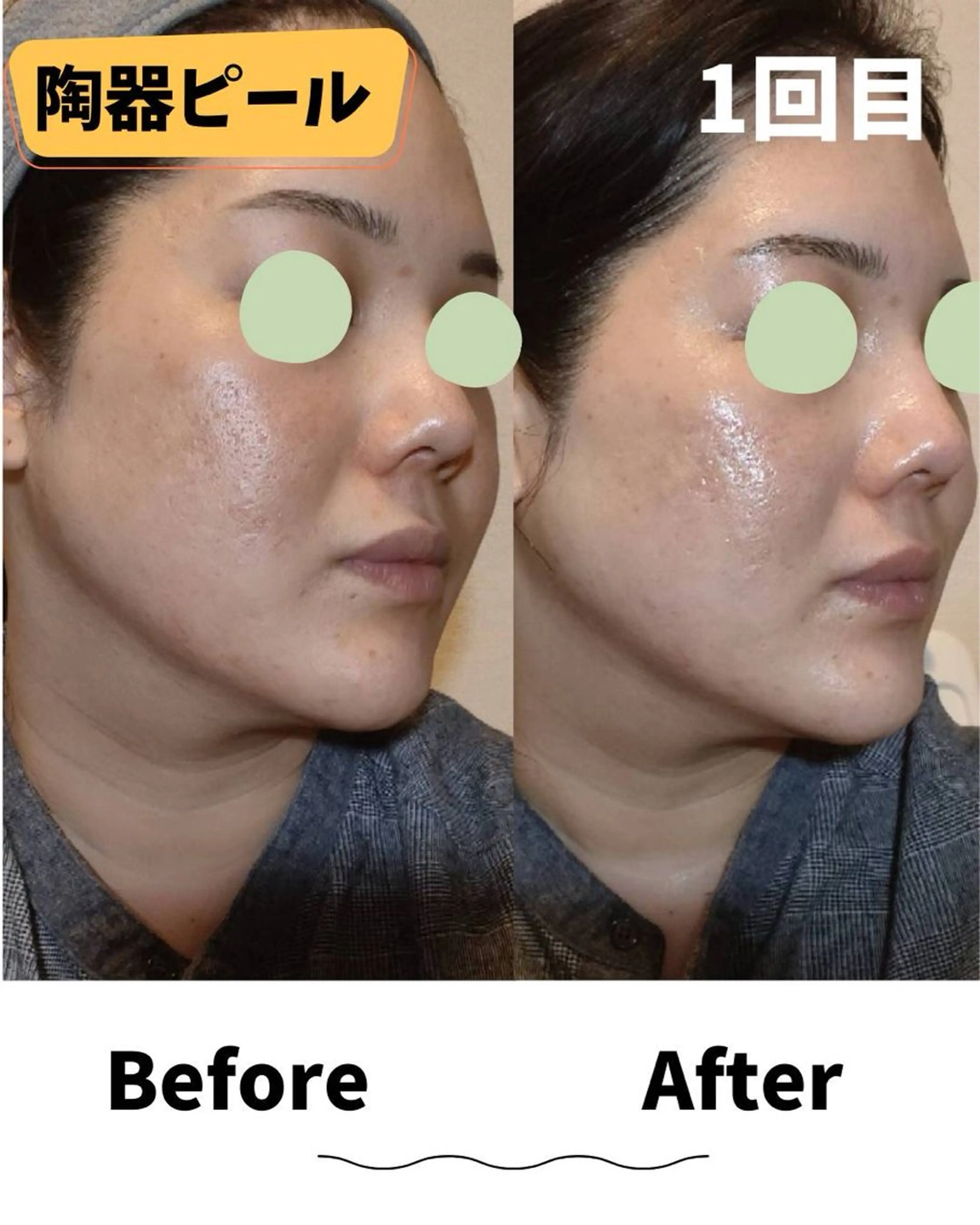 エステ コンセプトサロン〜友〜所属・コンセプトサロン友 木下のエステ・リラクイメージ