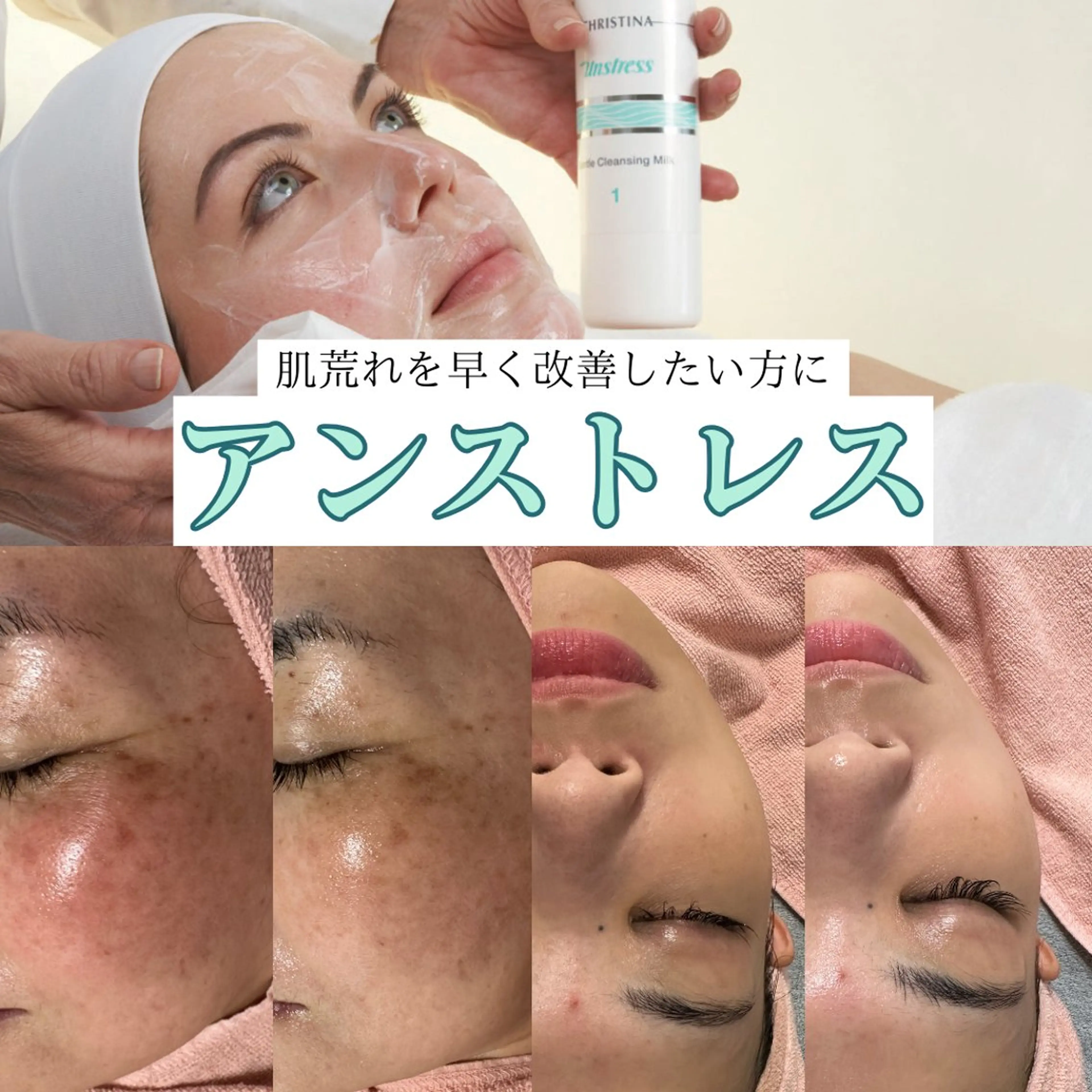 BestBelleꕤ 大阪福島/肌質改善のエステ・リラクイメージ