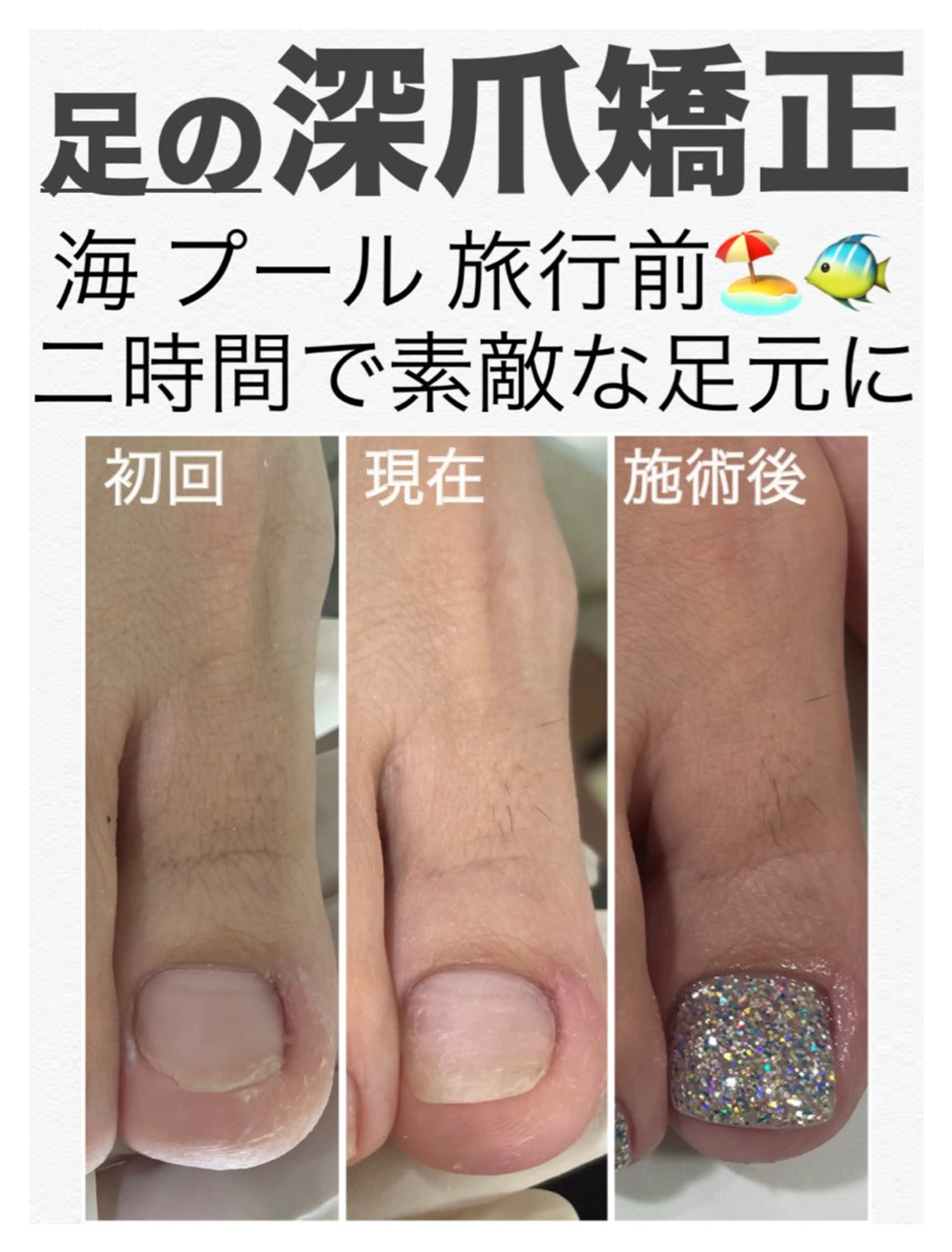 ネイル フットネイル petillant所属・nail salon petillantのネイルデザイン