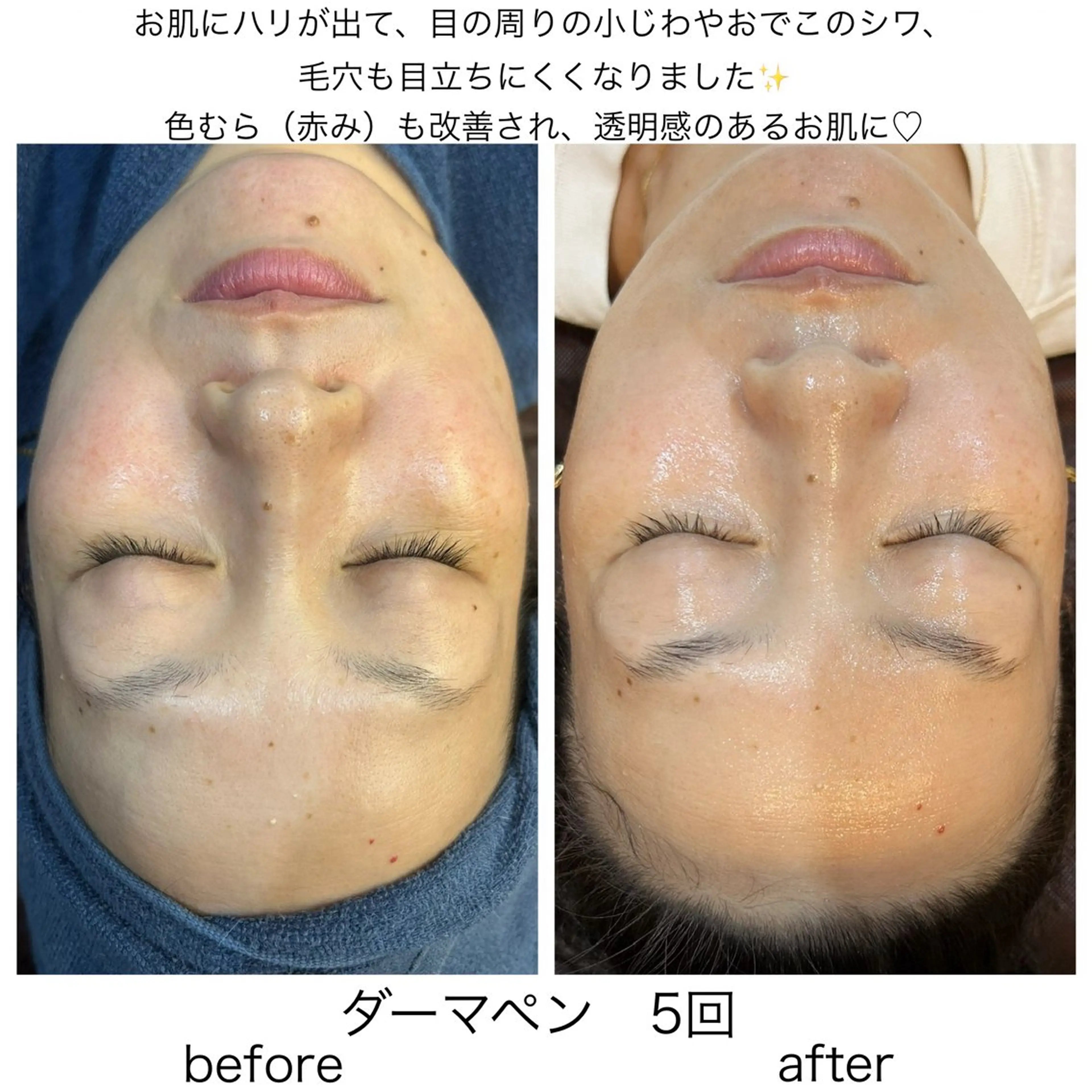 leolo武蔵浦和 肌質改善&脱毛のエステ・リラクイメージ