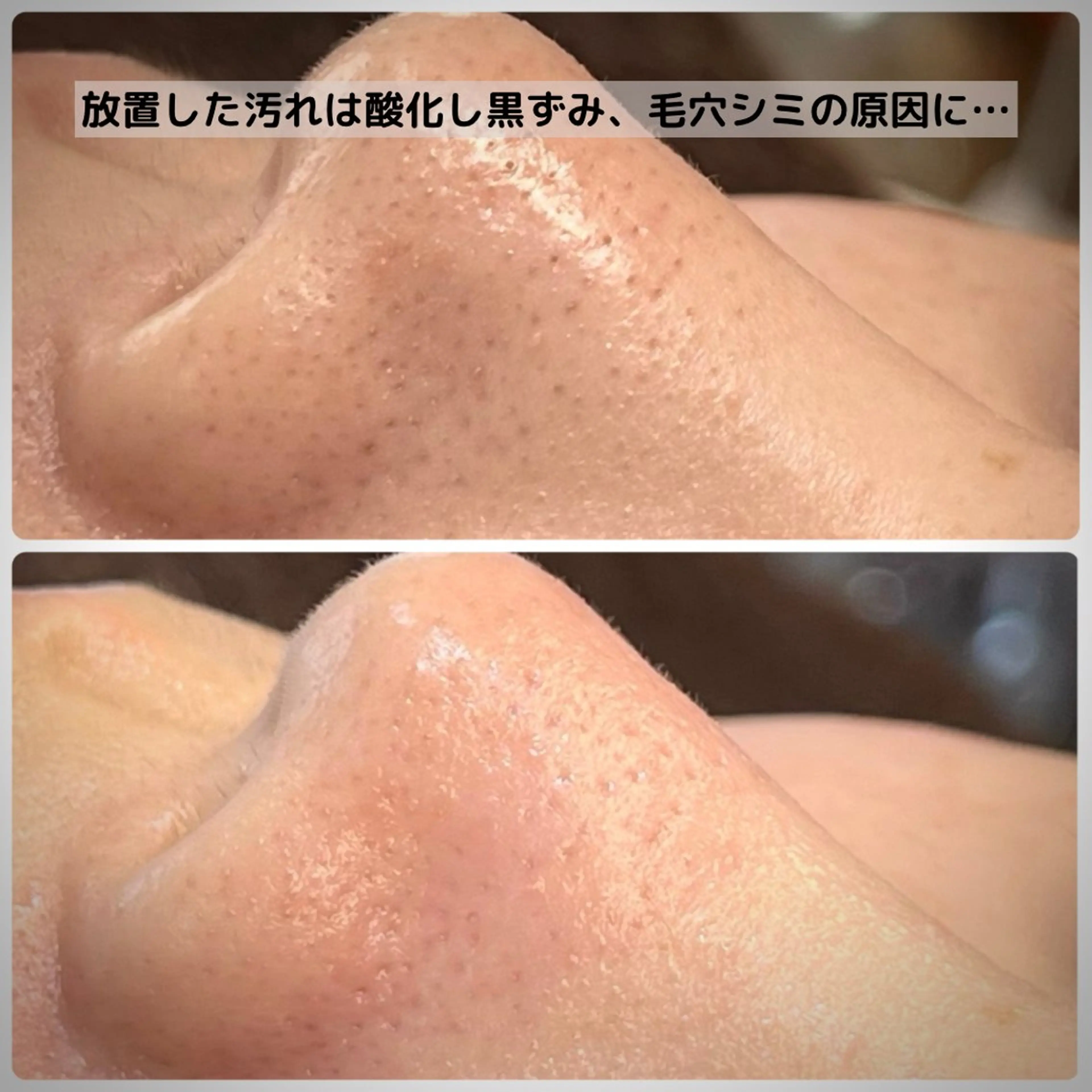 エステ Muqu.所属・Muqu. 毛穴サロンのエステ・リラクイメージ