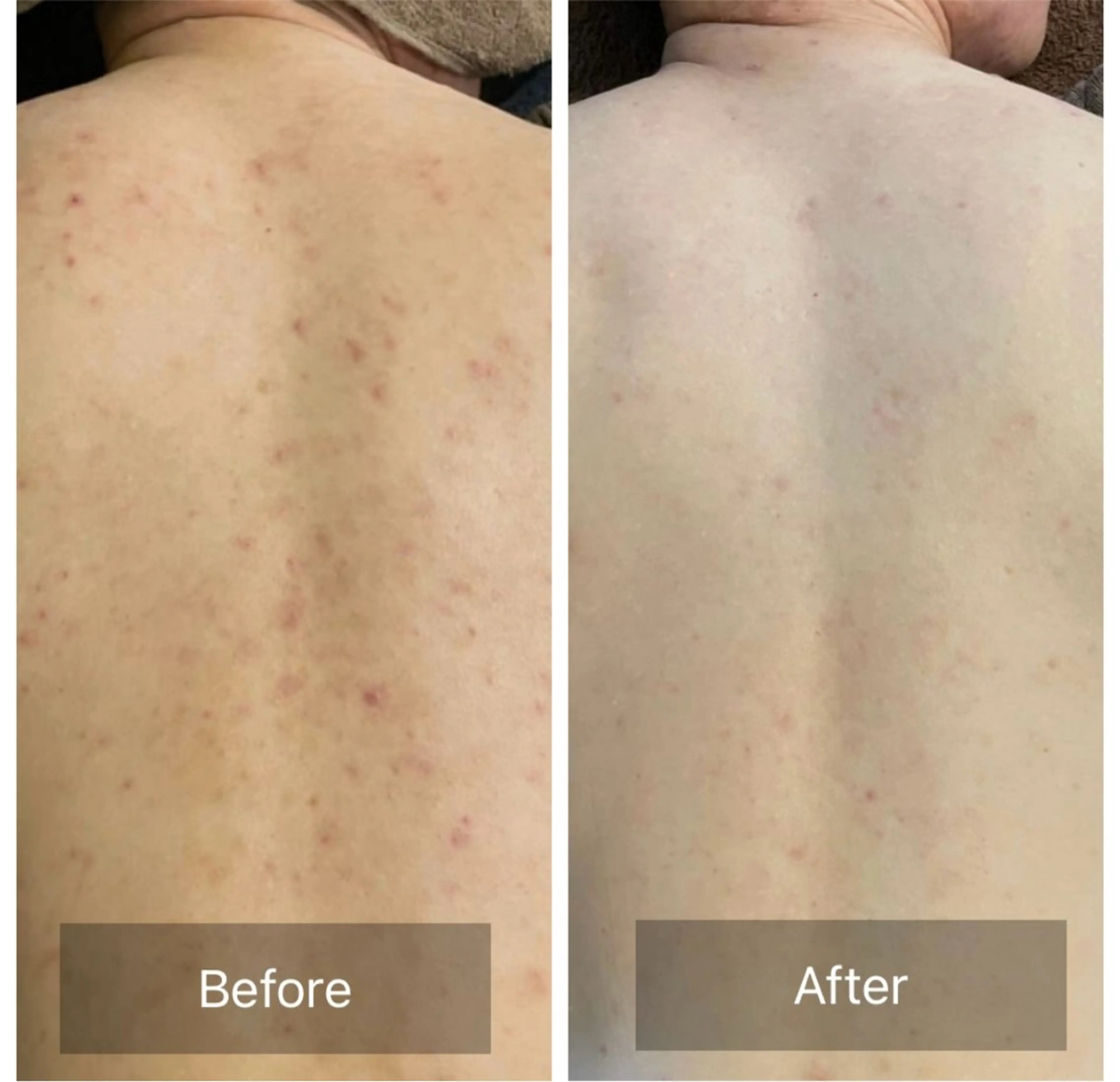 エステ ハーブピーリング 専門／今榮麻美のエステ・リラクイメージ