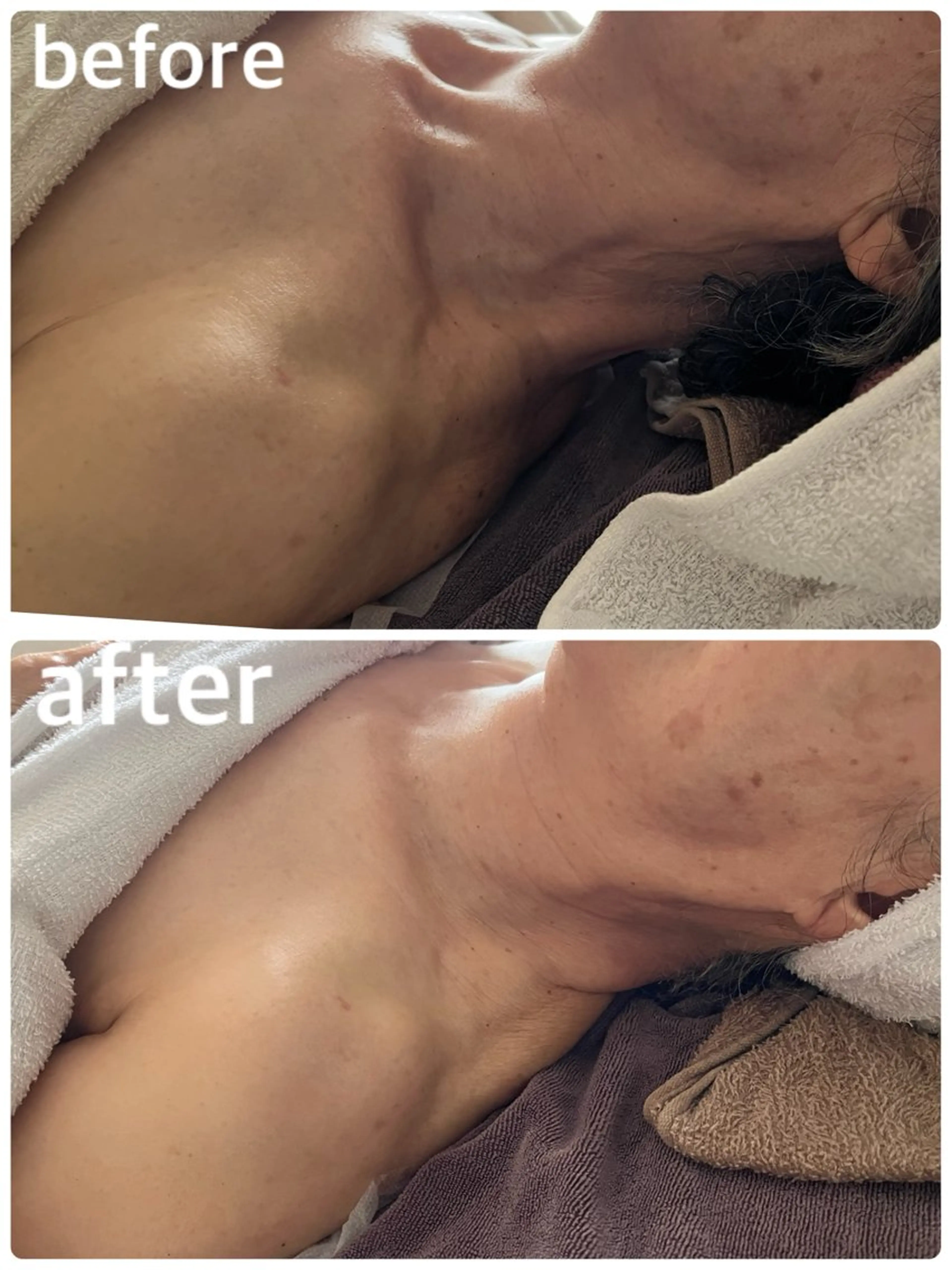 リラク YURUMARU所属・YURUMARU 河ノ瀬店のエステ・リラクイメージ