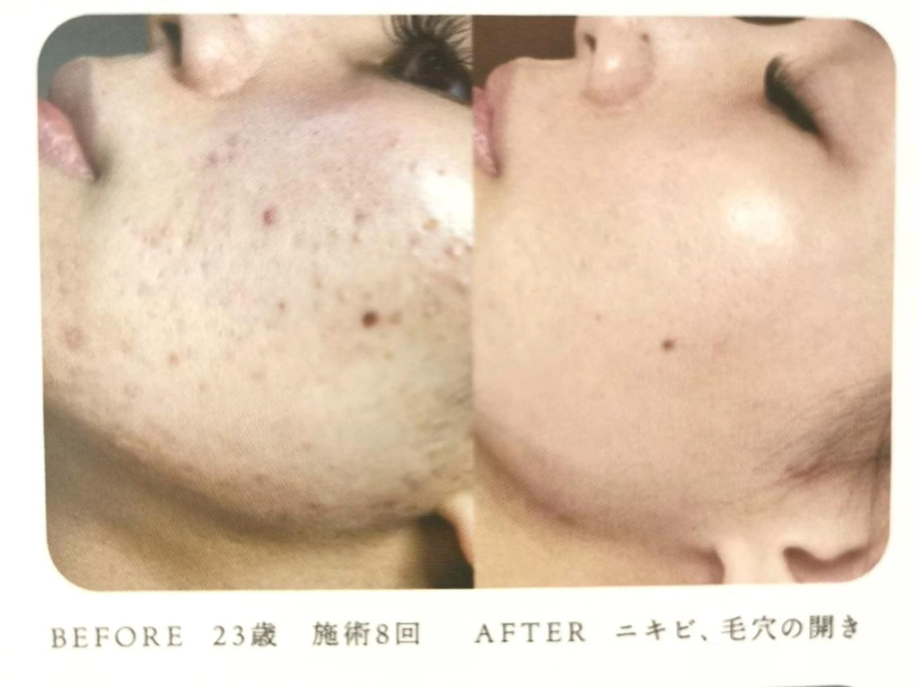 むくみ専門痩身 マクイエステティックのエステ・リラクイメージ