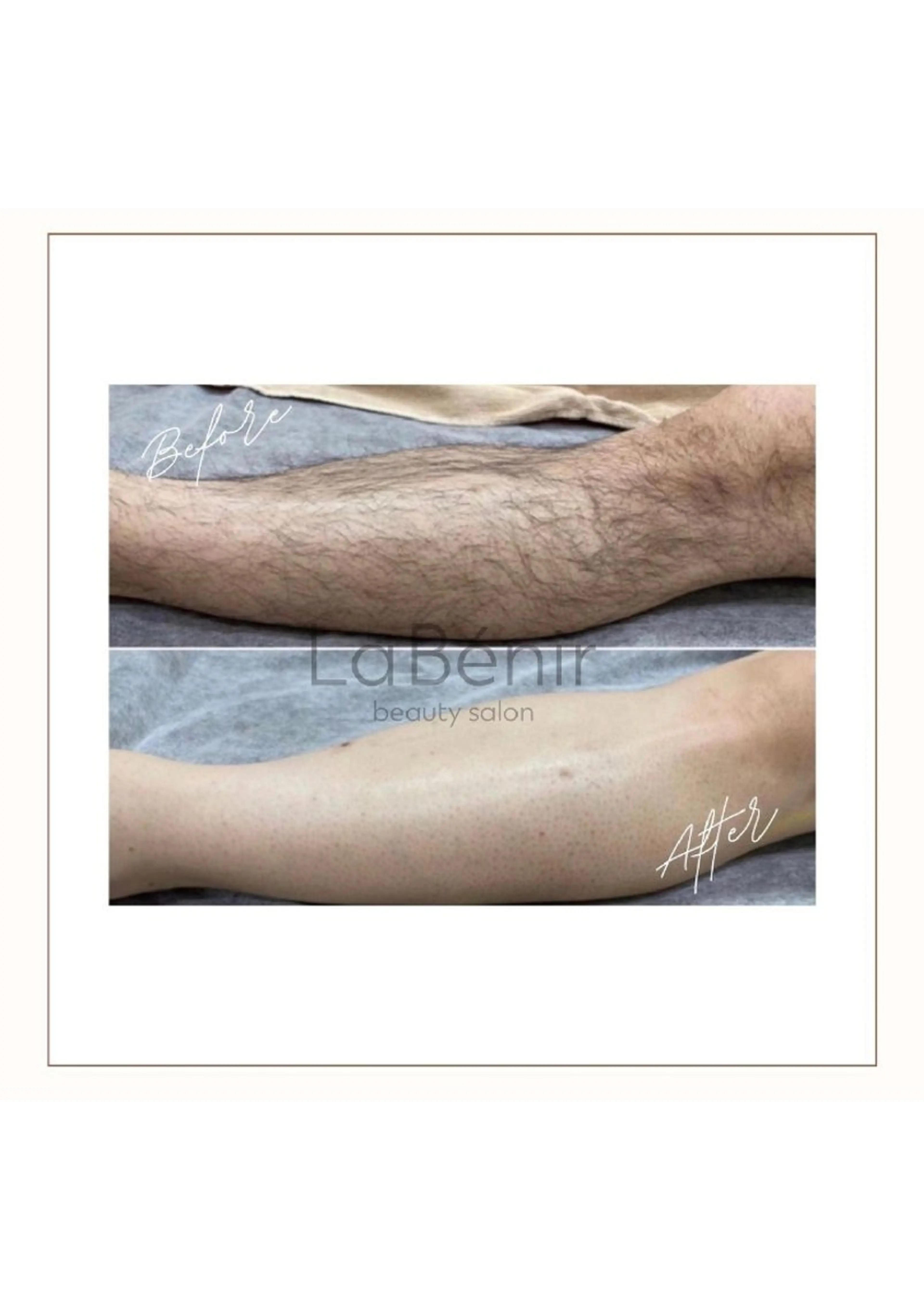 メンズ 脱毛 脱毛/美肌【皮膚科看 護師経営】ラベニールのエステ・リラクイメージ