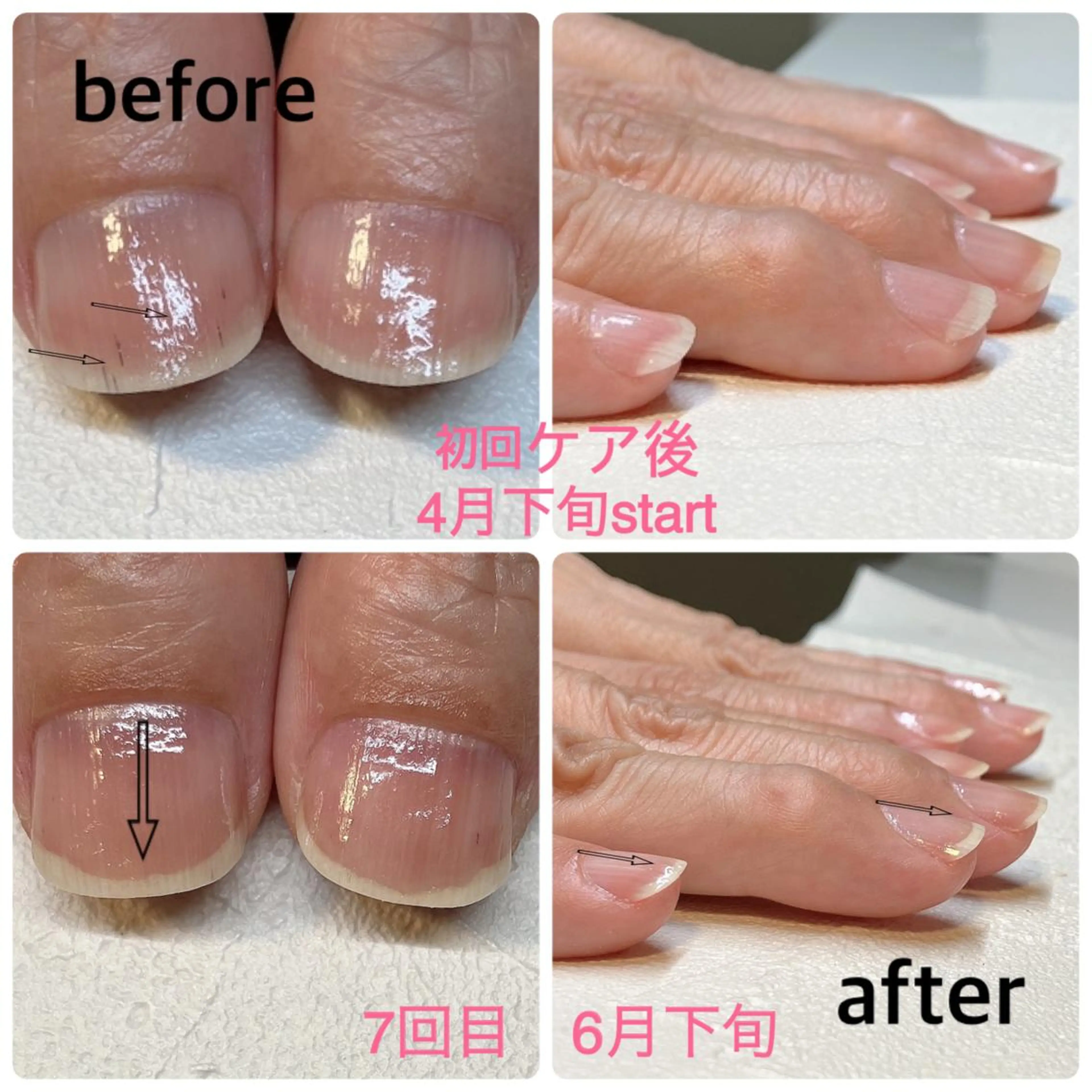 ネイル オフのみ(ネイル) nails 🎀meのネイルデザイン