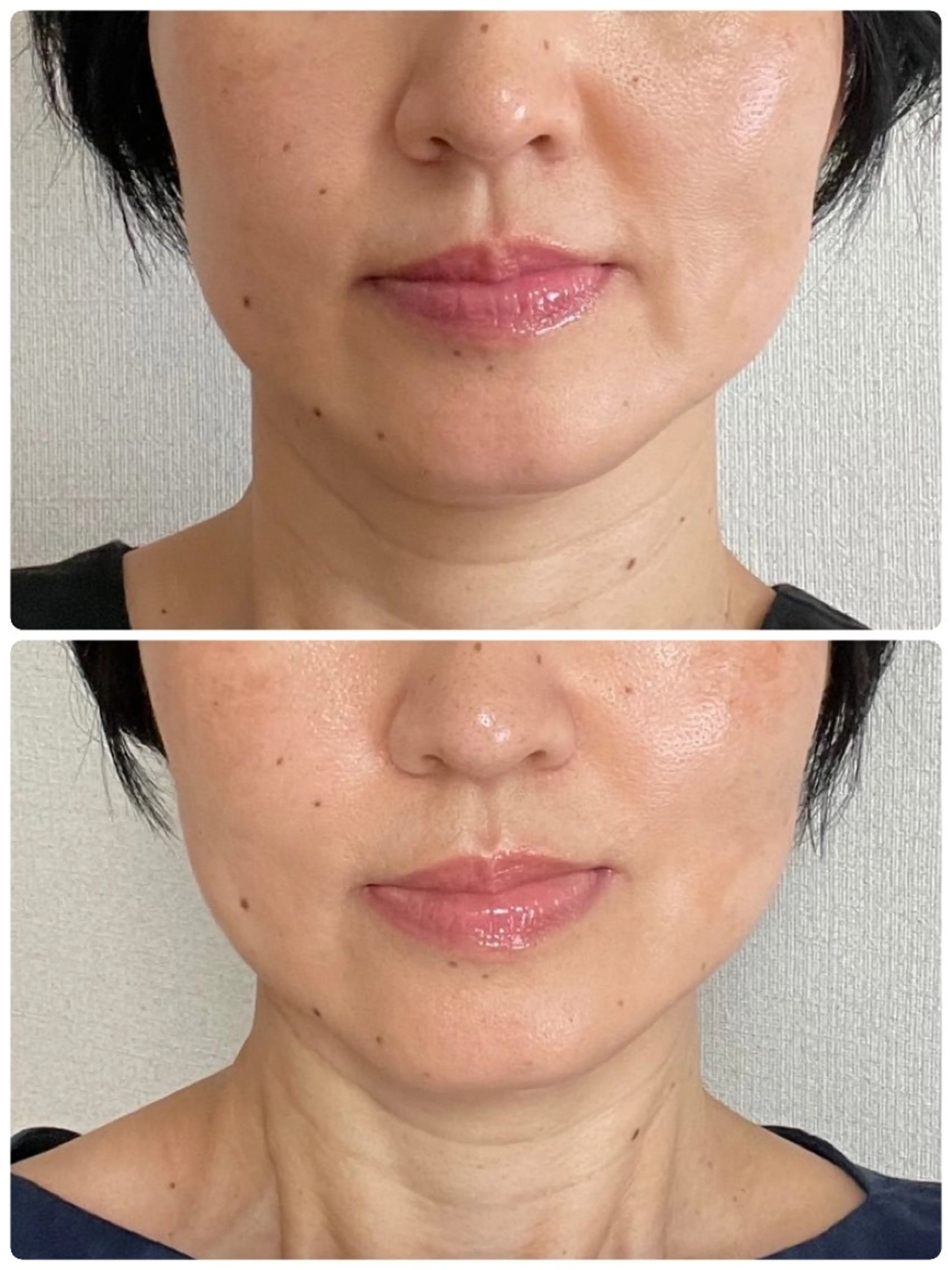 フェイシャルエステ アンソン・ドゥのエステ・リラクイメージ