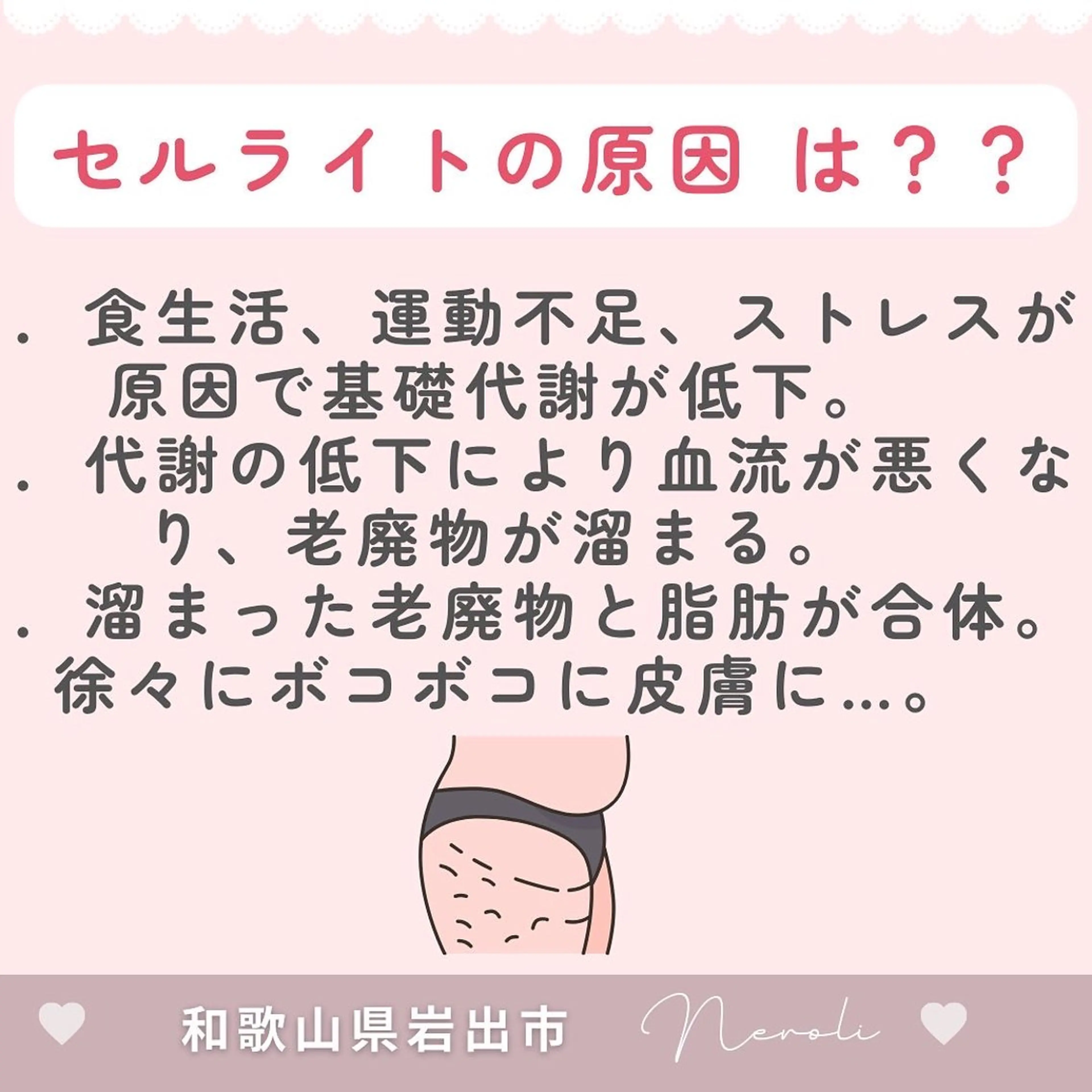 エステ 温活beautyサロンNeroli所属・切らない脂肪吸引🔥 Neroliまりこのエステ・リラクイメージ