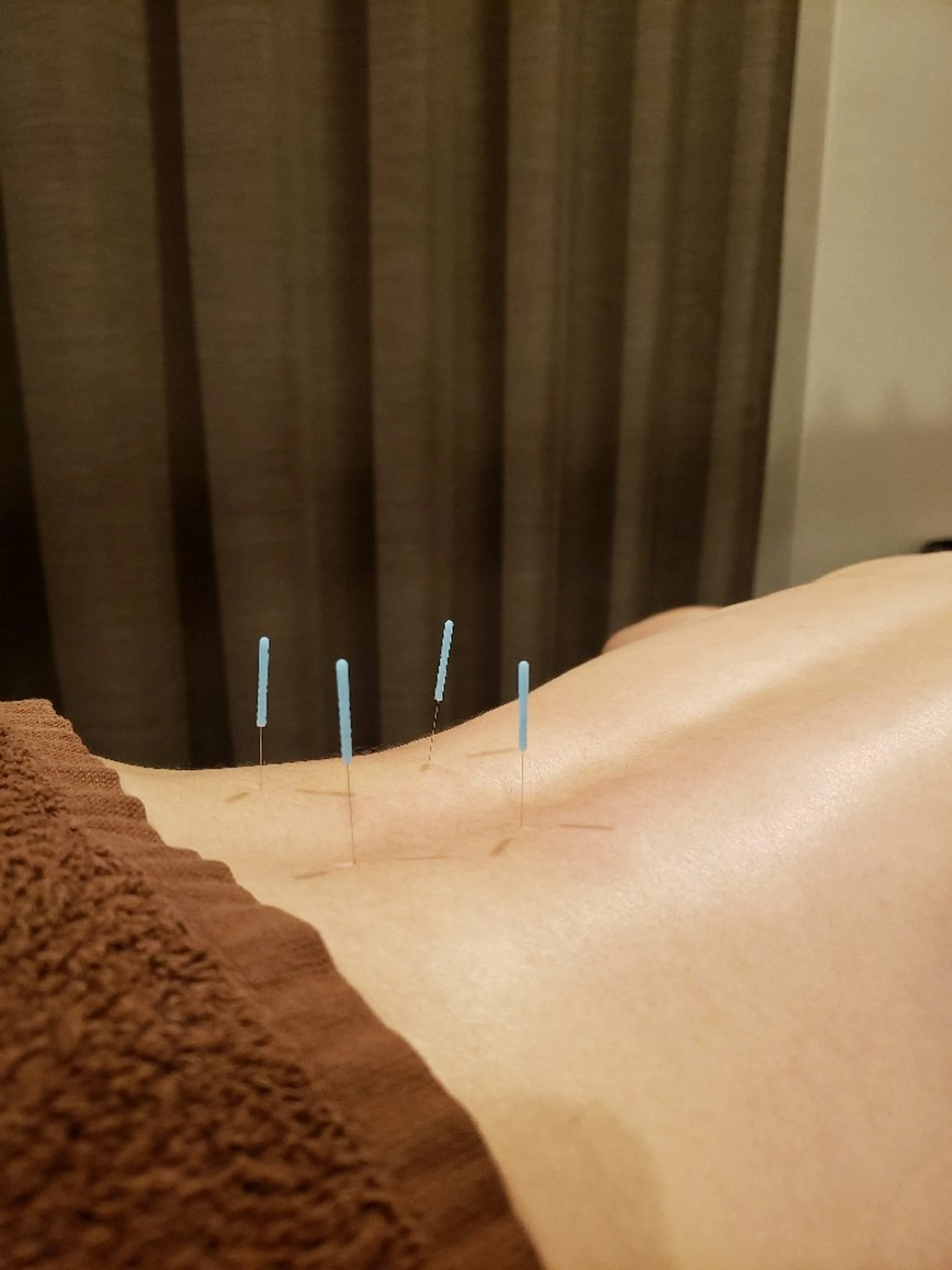 アイブロウ MYCARE吉祥寺所属・MYCARE 鍼灸&マッサージ代表のエステ・リラクイメージ