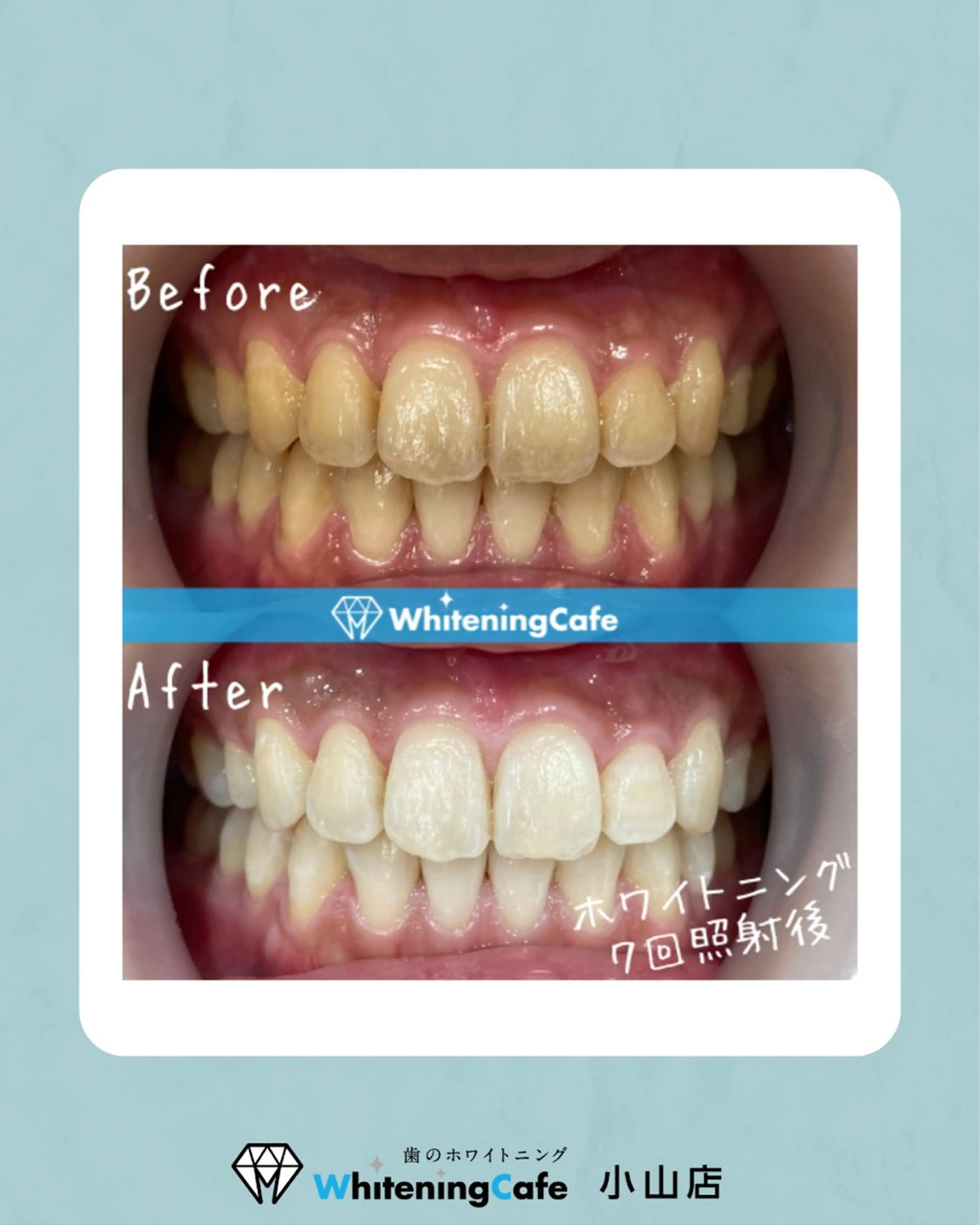 ホワイトニングカフェ 小山店のエステ・リラクイメージ