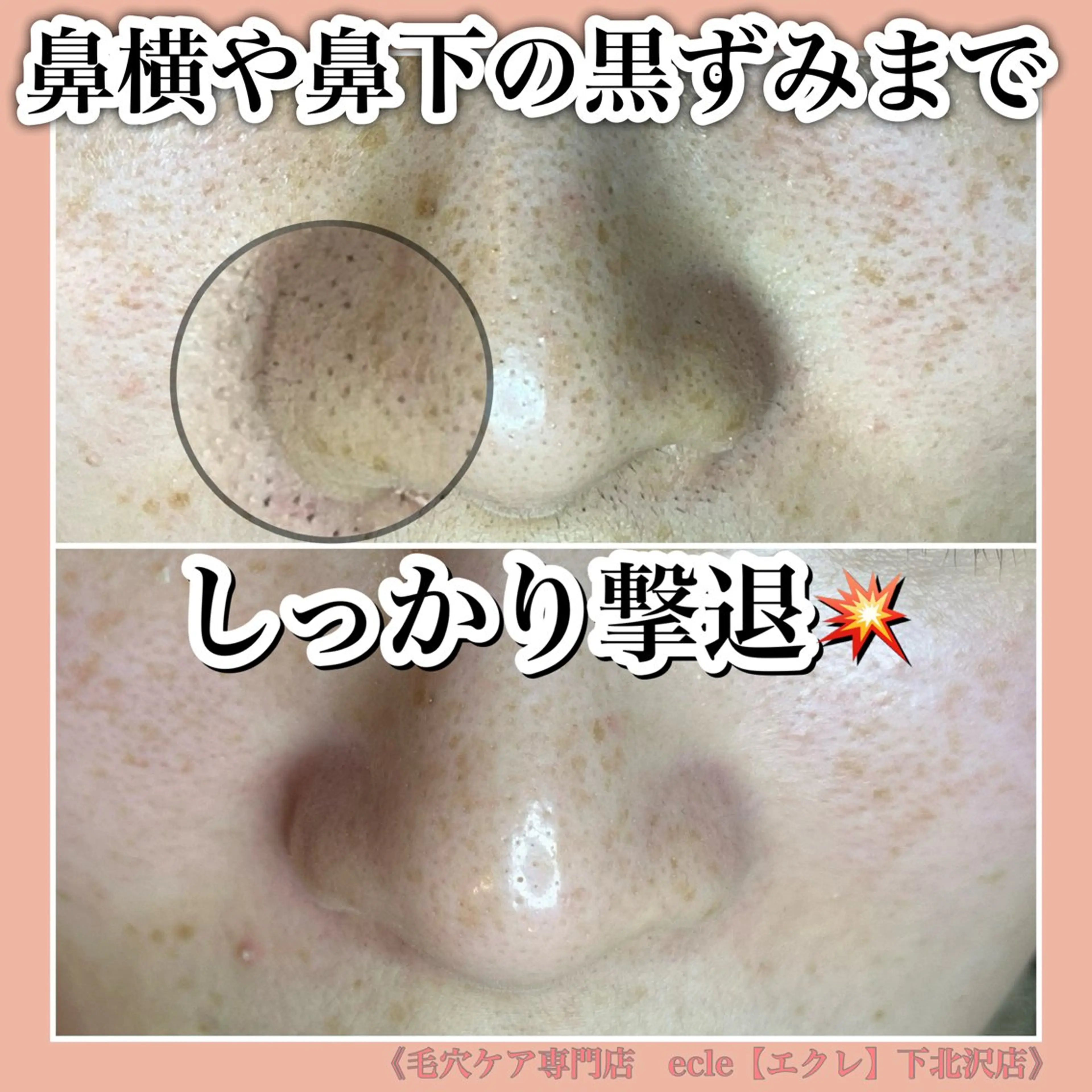 ecle ericaのエステ・リラクイメージ