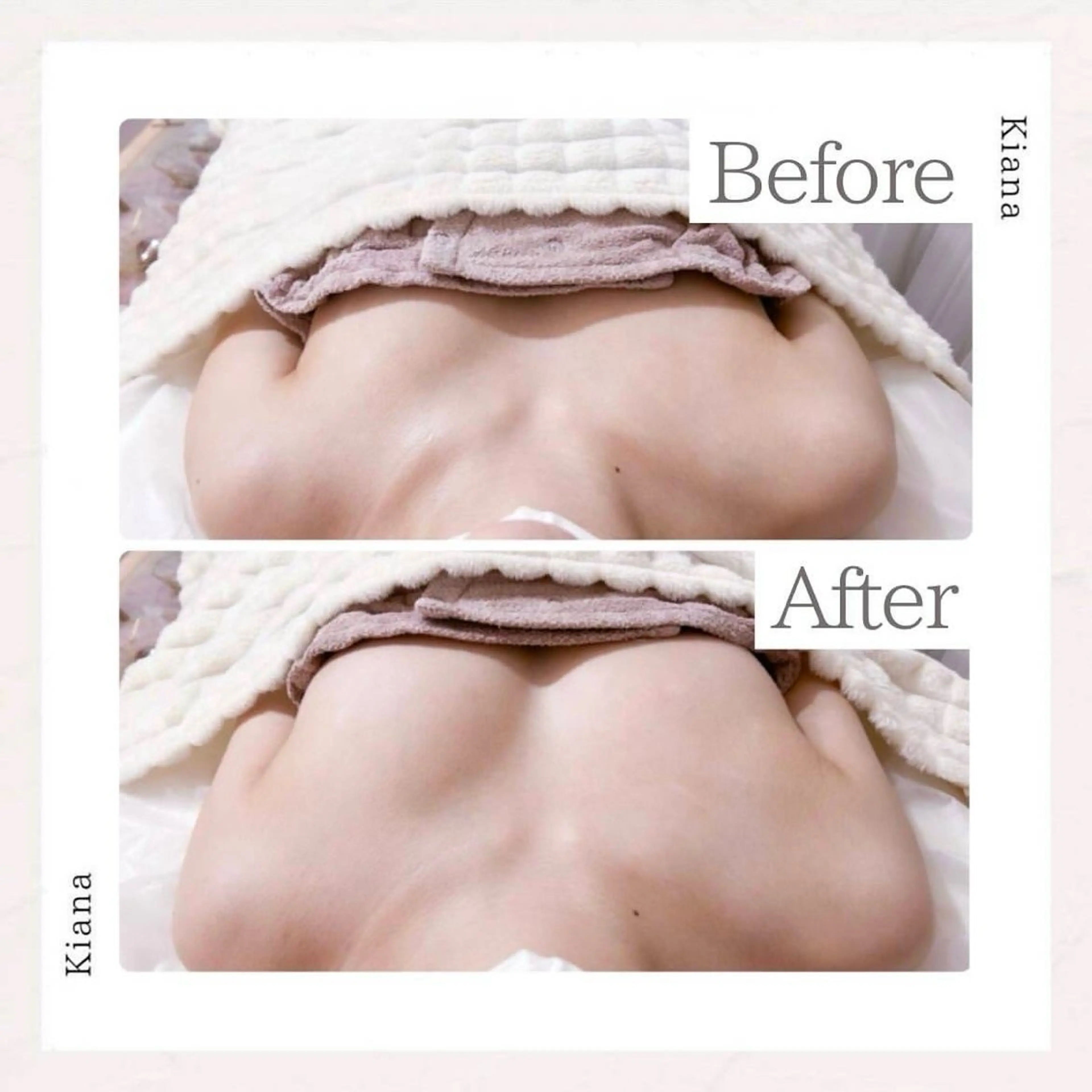 エステ リラク バスト専門Kiana 風のエステ・リラクイメージ