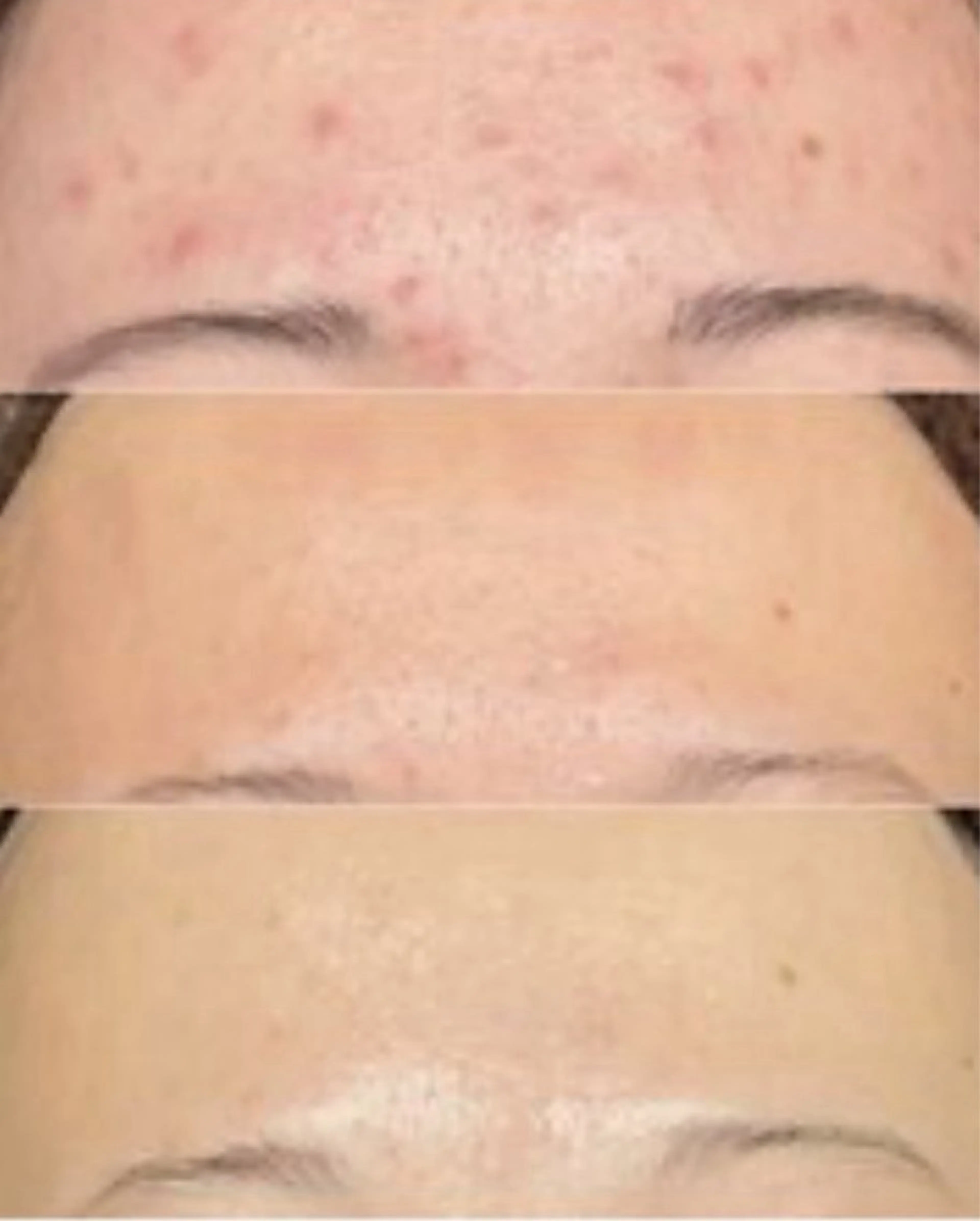 肌質改善専門サロンAte国分寺店所属・Ate Rikaのエステ・リラクイメージ