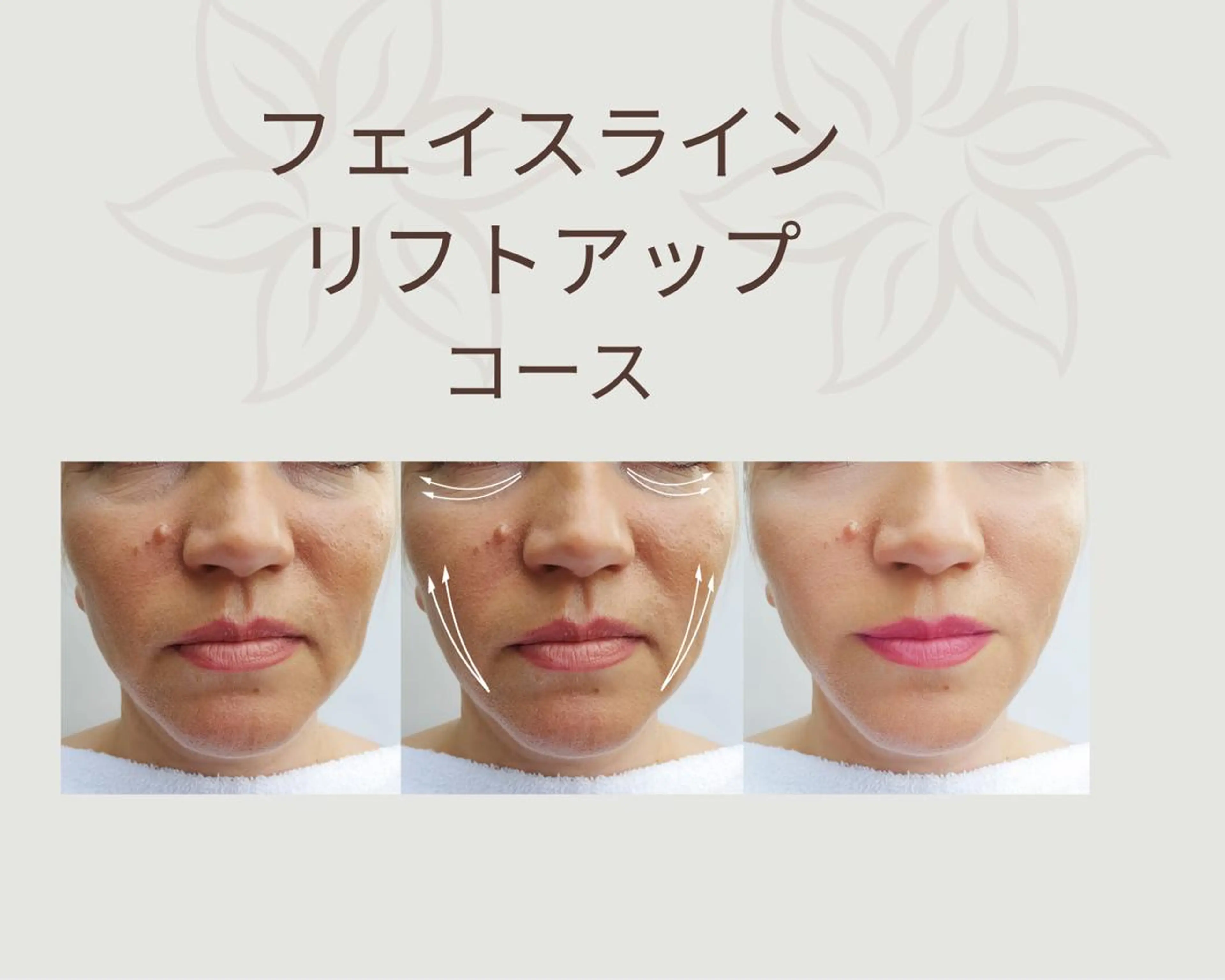 ⭐️ミニモ企画⭐️【フェイスライン】リフトアップコースの写真