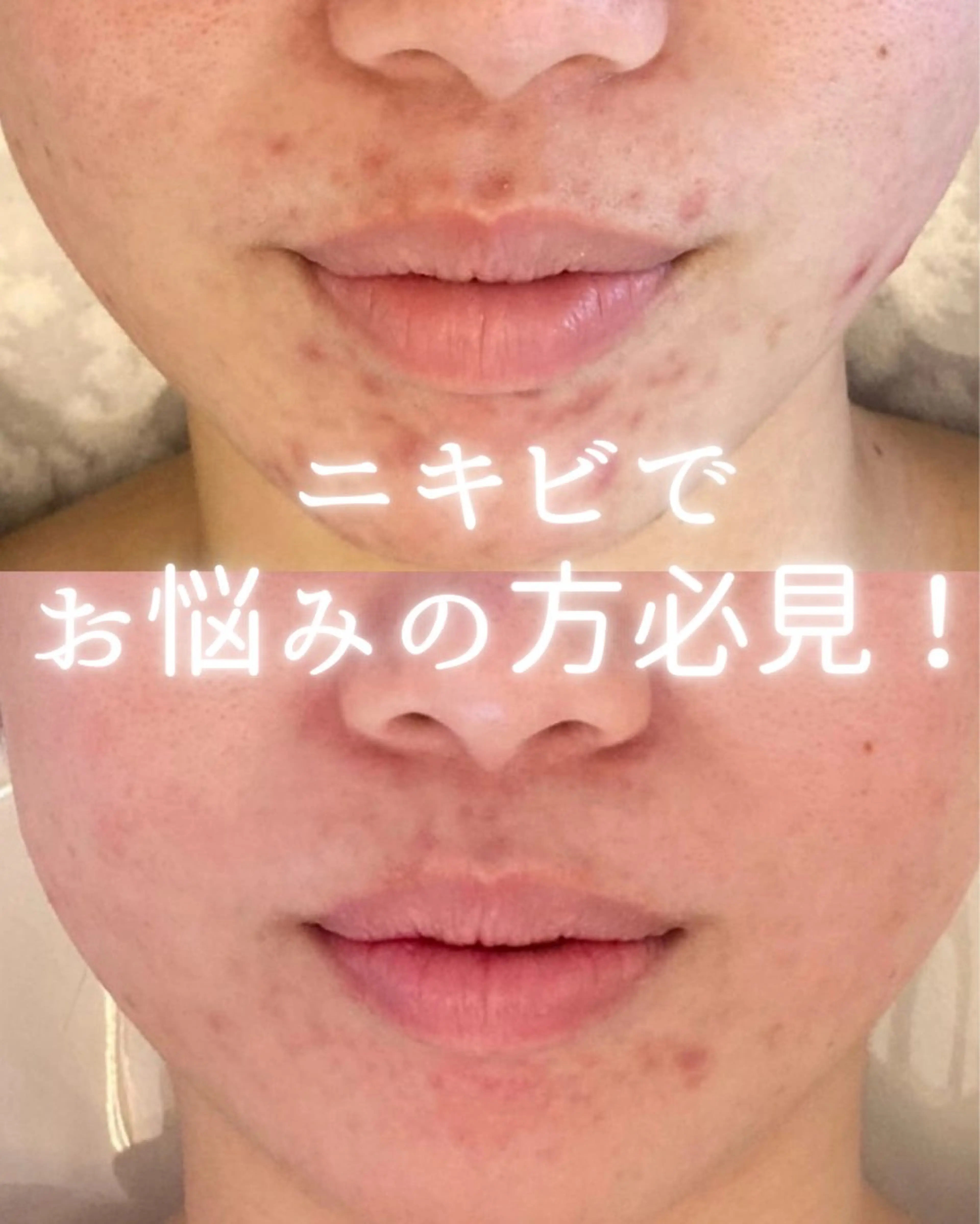 private beauty salon Lilby所属・リルビー 肌育・肌質改善サロンのその他イメージ