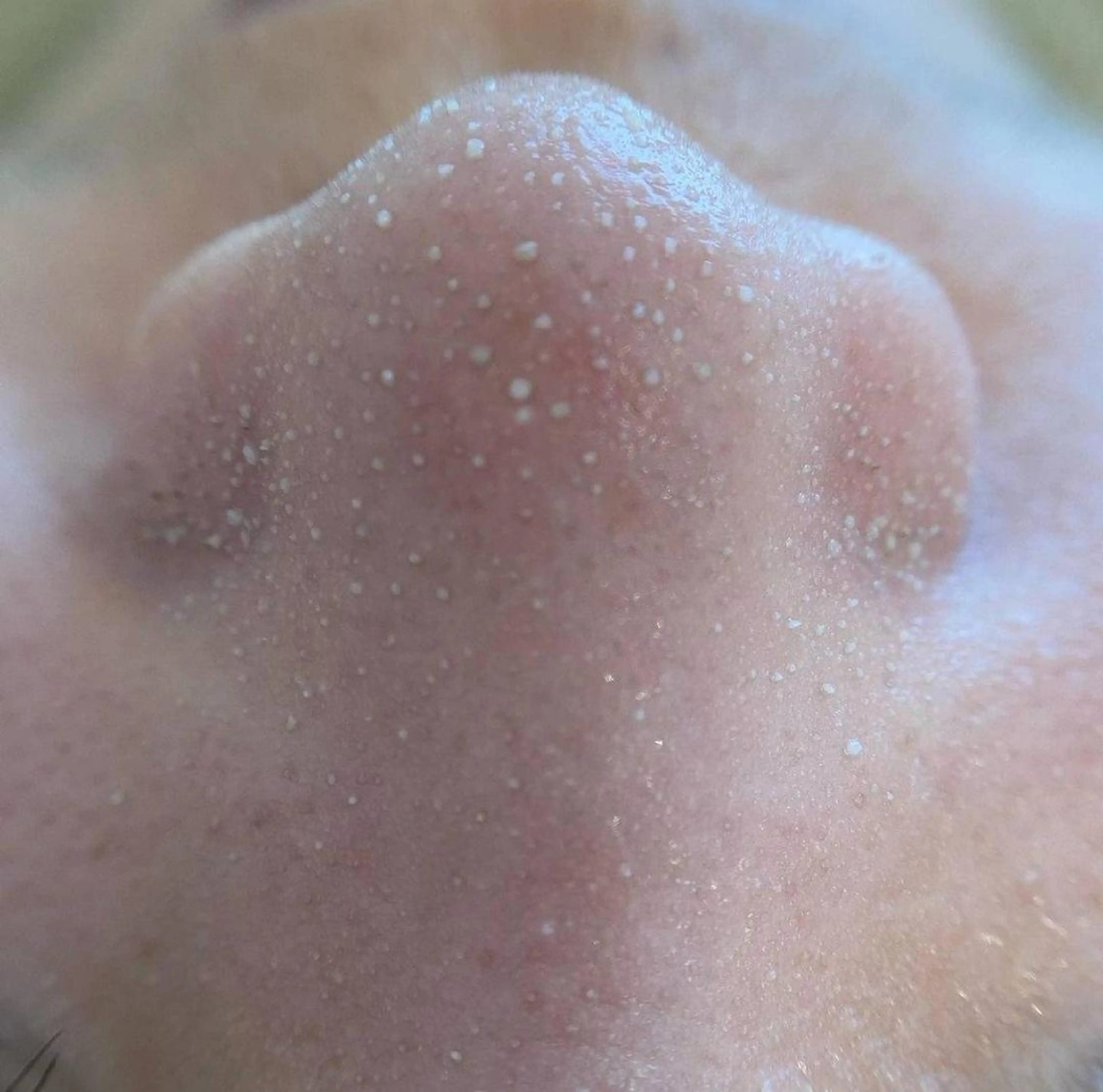 エステ 小林 理恵のエステ・リラクイメージ