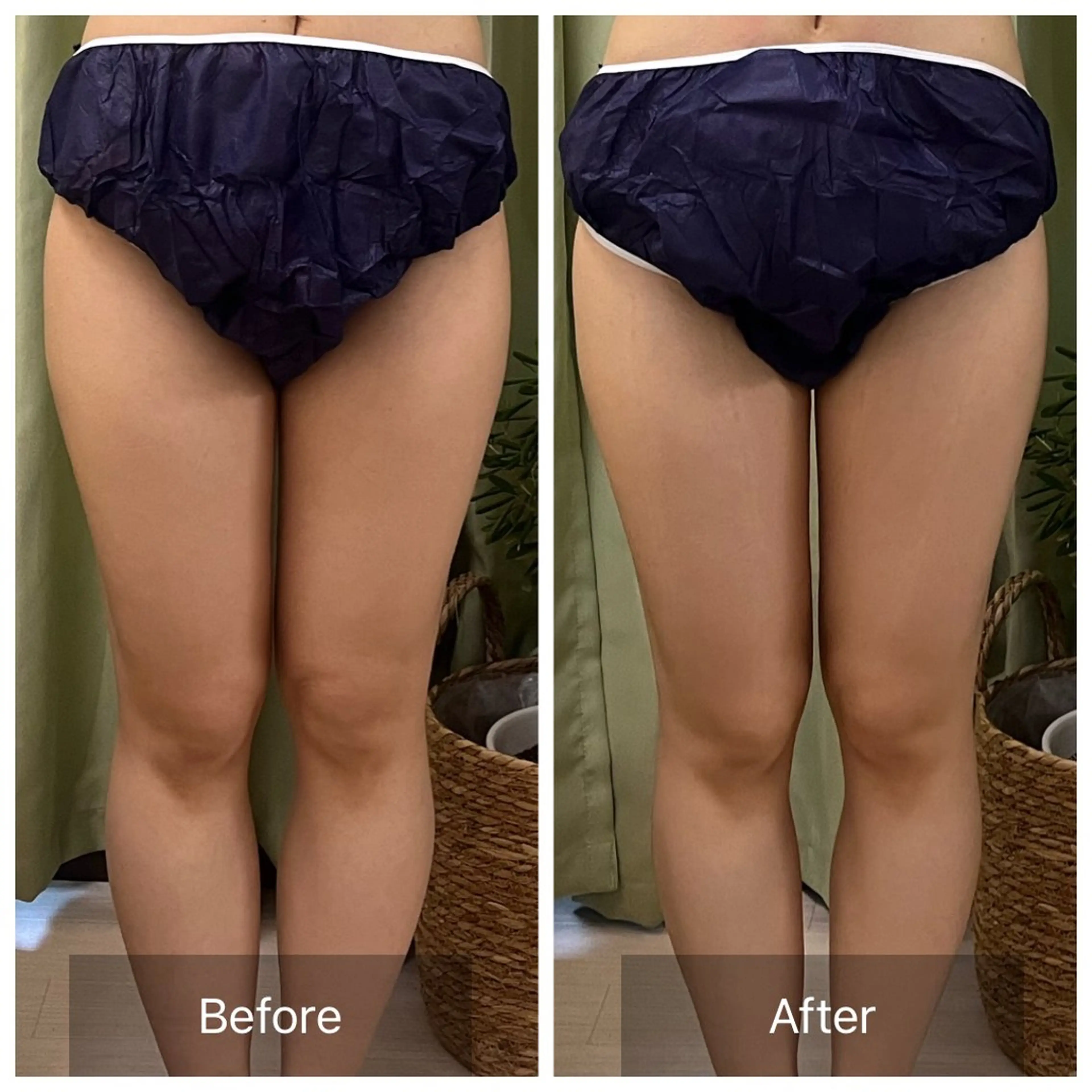 【元に戻らない】 小顔&部分痩せのその他イメージ