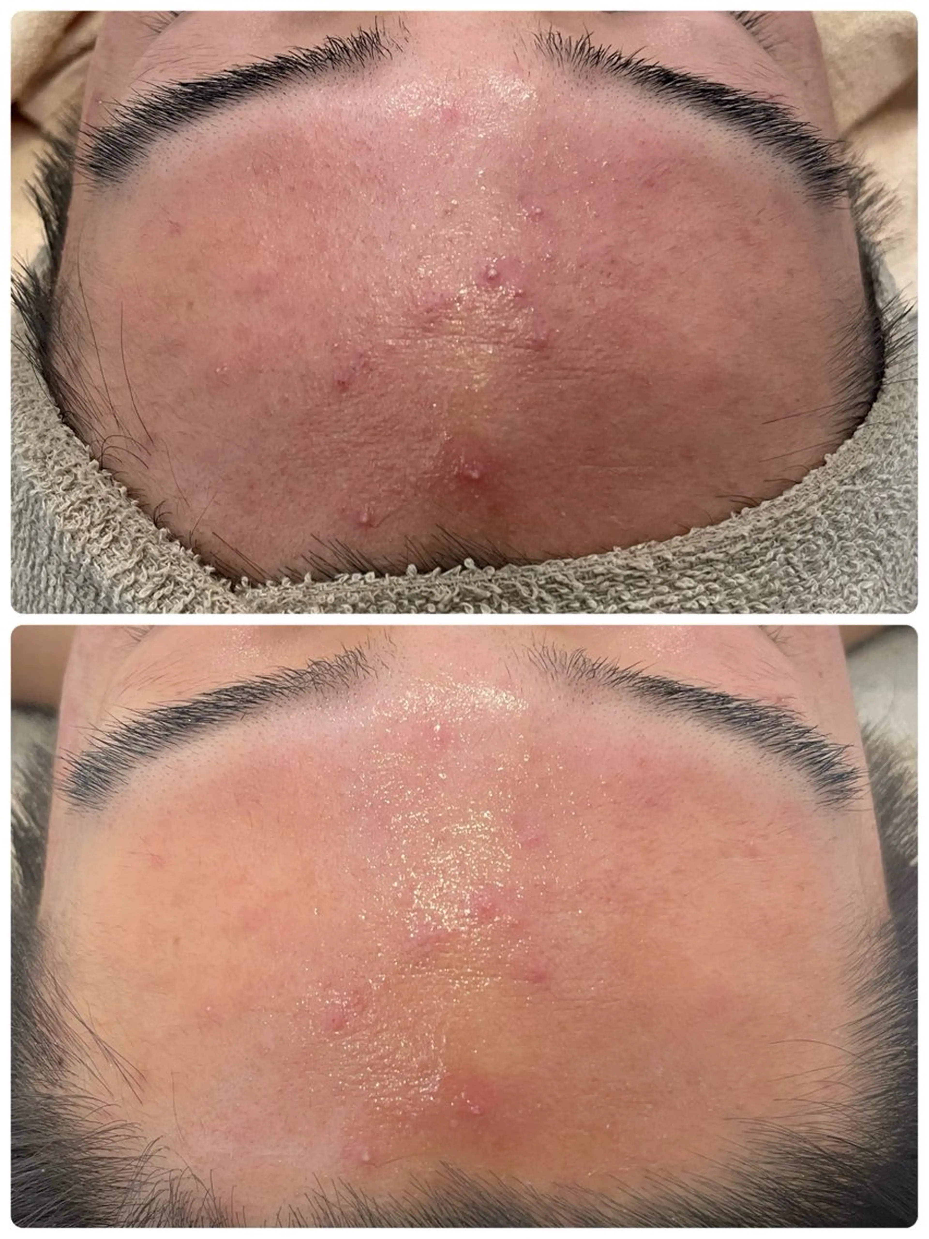 エステ total beauty TLIENGLE［ﾄﾘｱﾝｸﾞﾙ］所属・tliengle ［ﾄﾘｱﾝｸﾞﾙ］のネイルデザイン