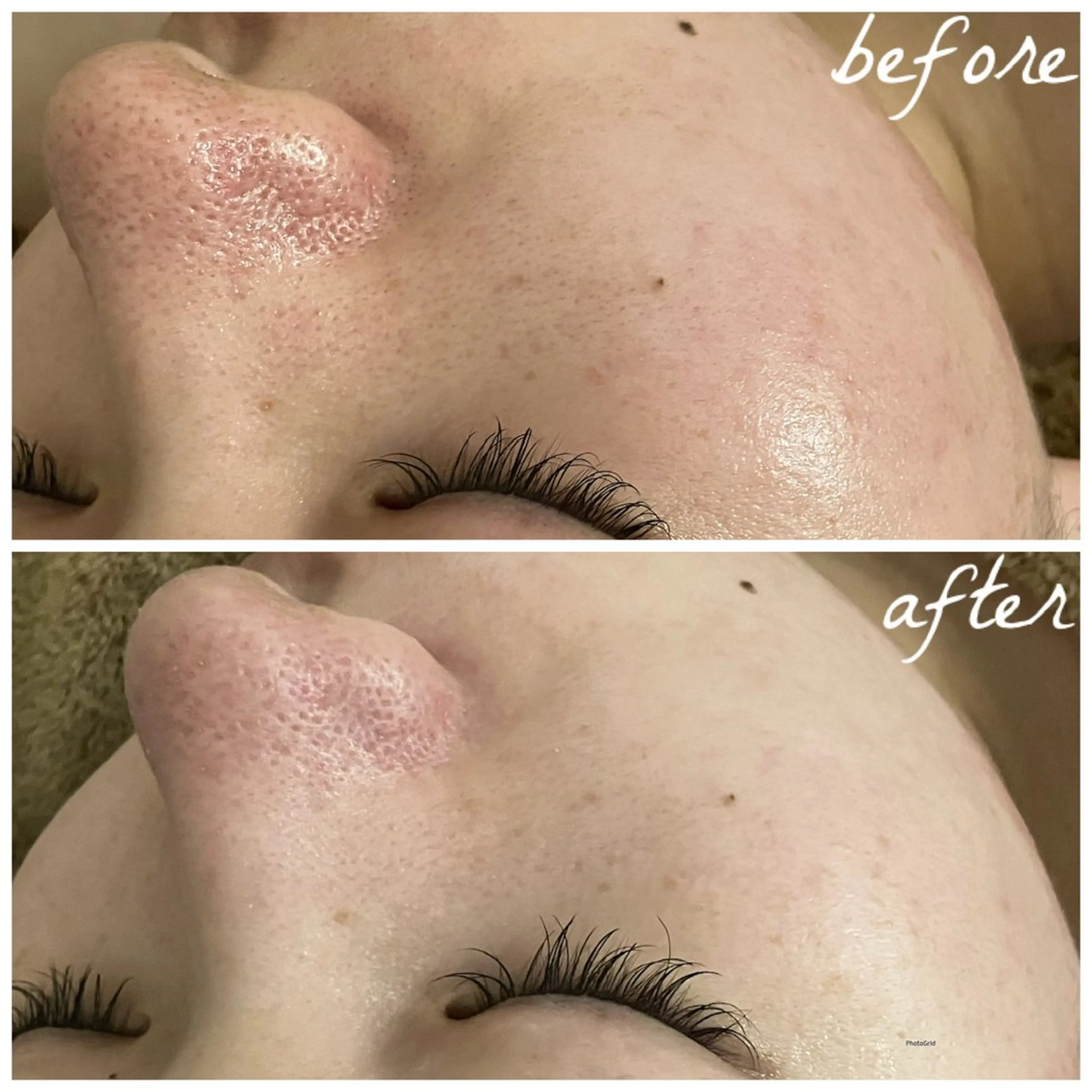 メンズ エステ メナード岐阜茜部 杉浦のエステ・リラクイメージ