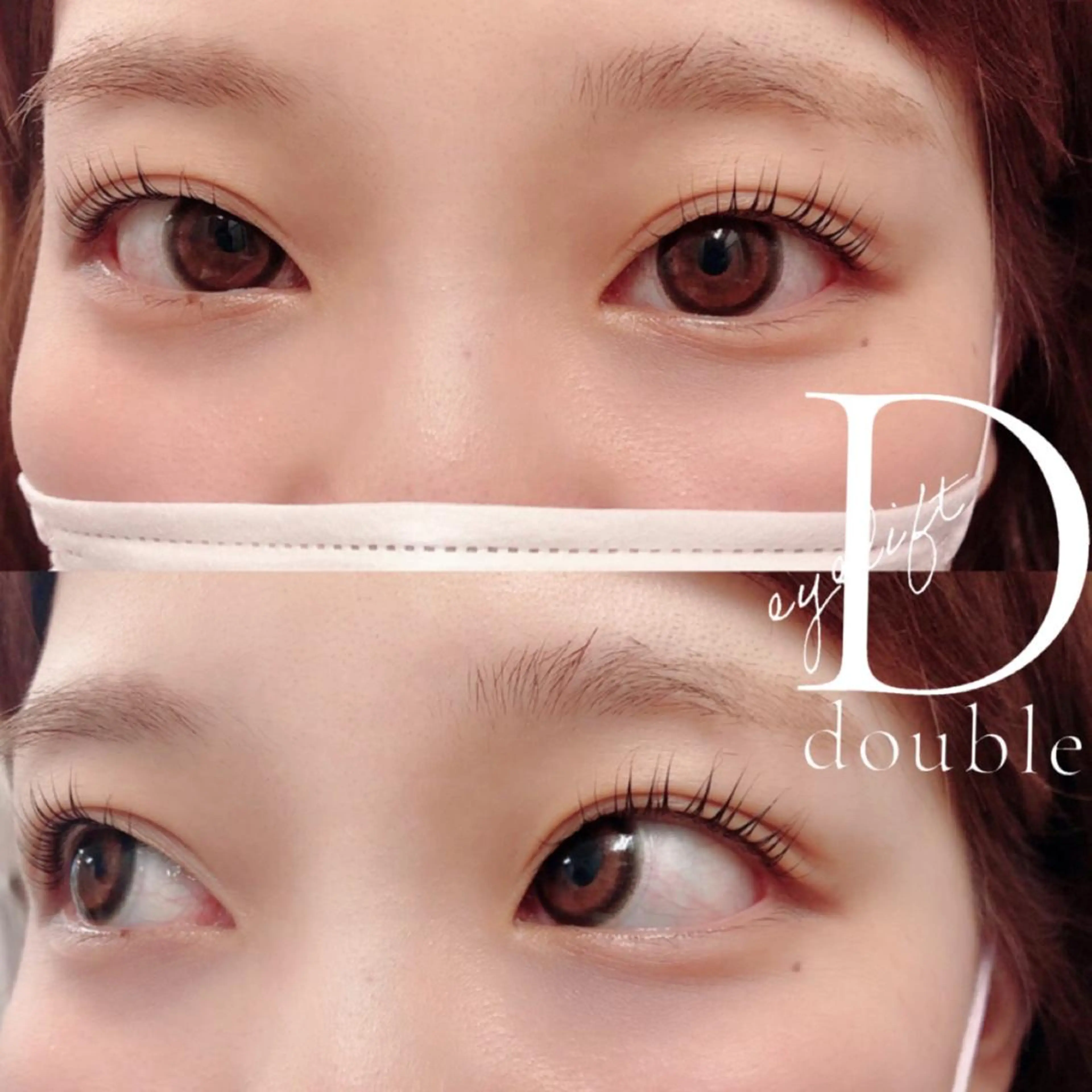 二重に導く瞼へ【ダブルアイリフト】目元美容整体×ラッシュリフトの写真