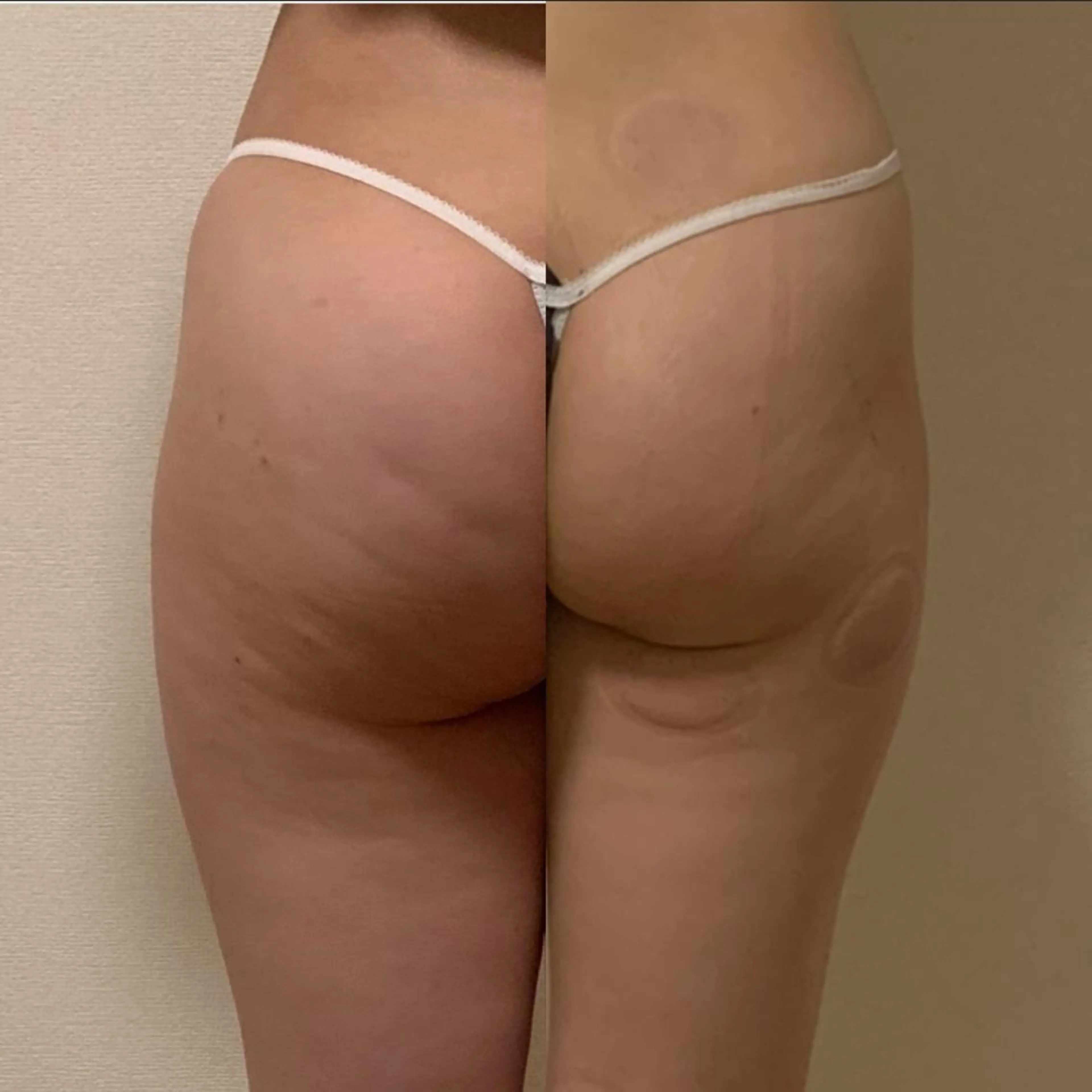 a  room salonのエステ・リラクイメージ