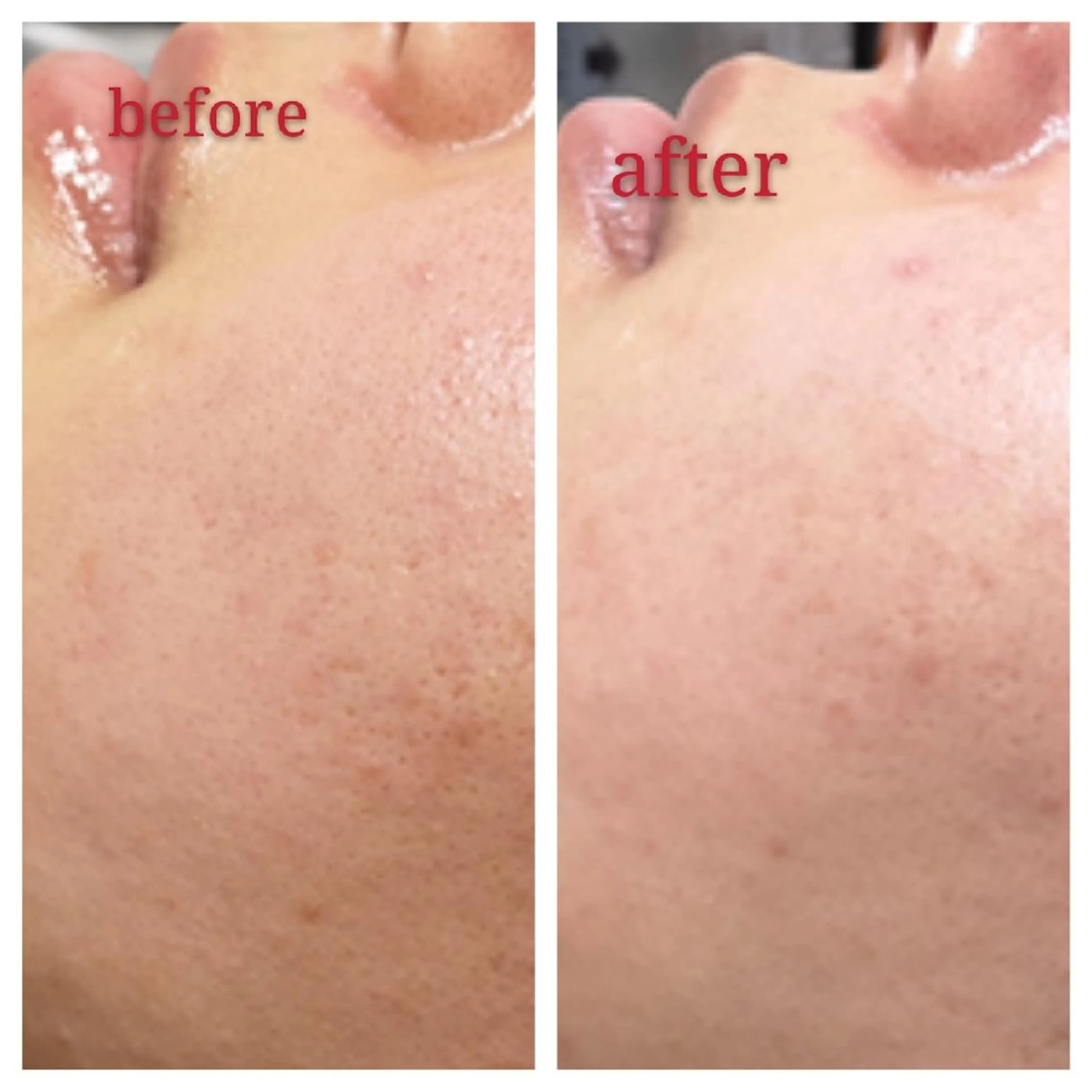 🅖🅤🅩🅔🅛 salonのエステ・リラクイメージ