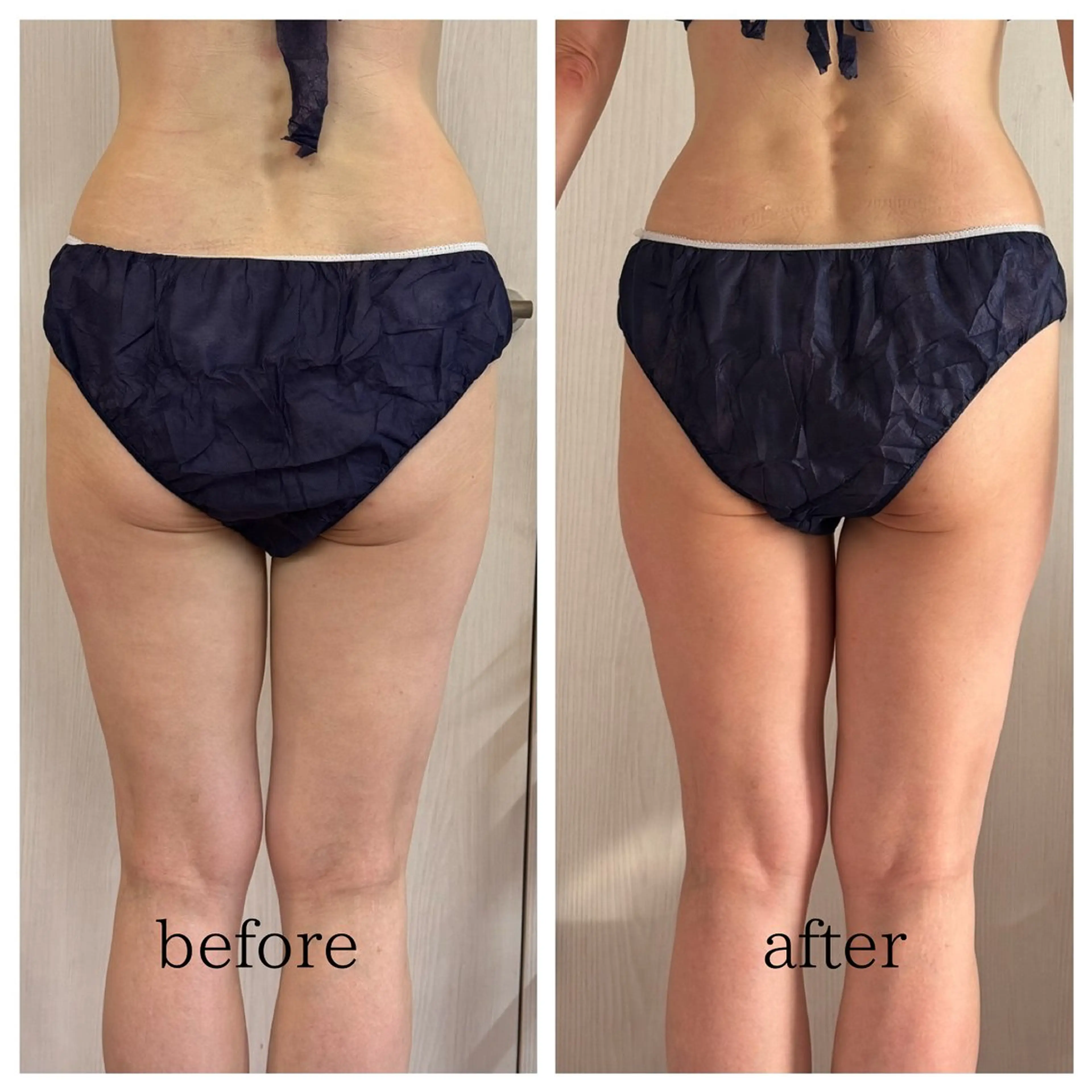 エステ 武藤 千裕のエステ・リラクイメージ