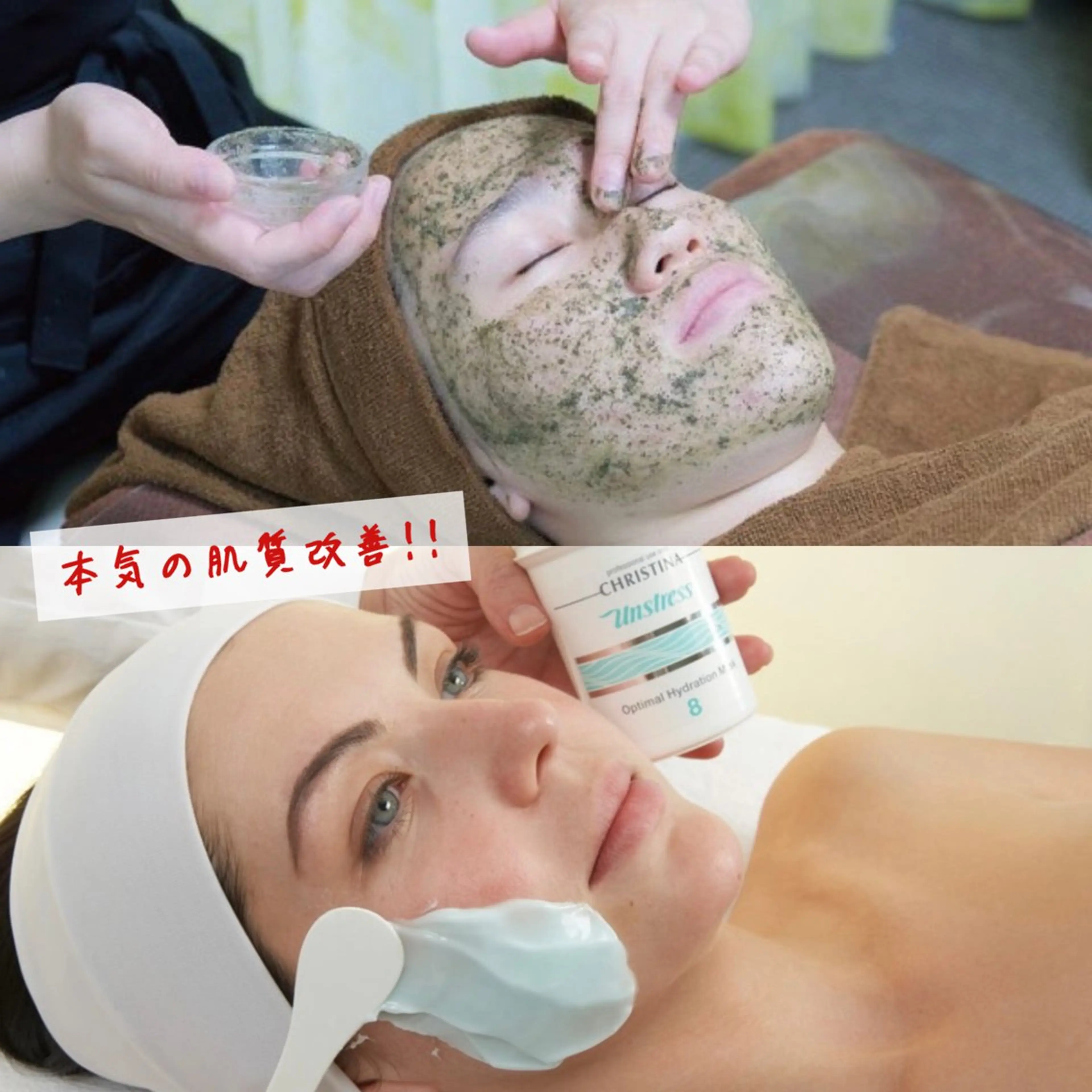 【モニター募集中!!】本気の肌質改善🔥5回コースの写真