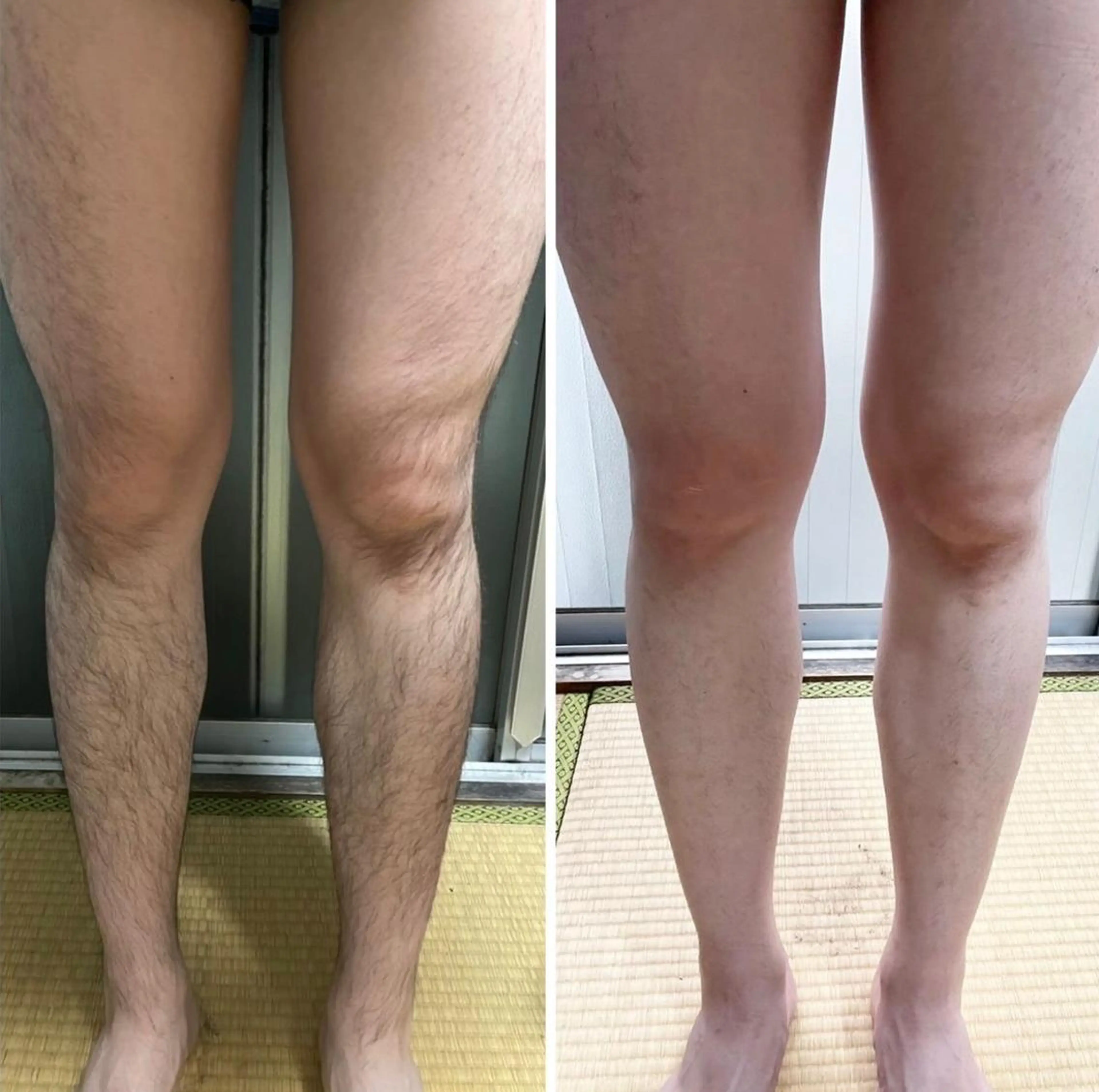 メンズ【脚まるごと】短パンはいてもキレイ！の写真