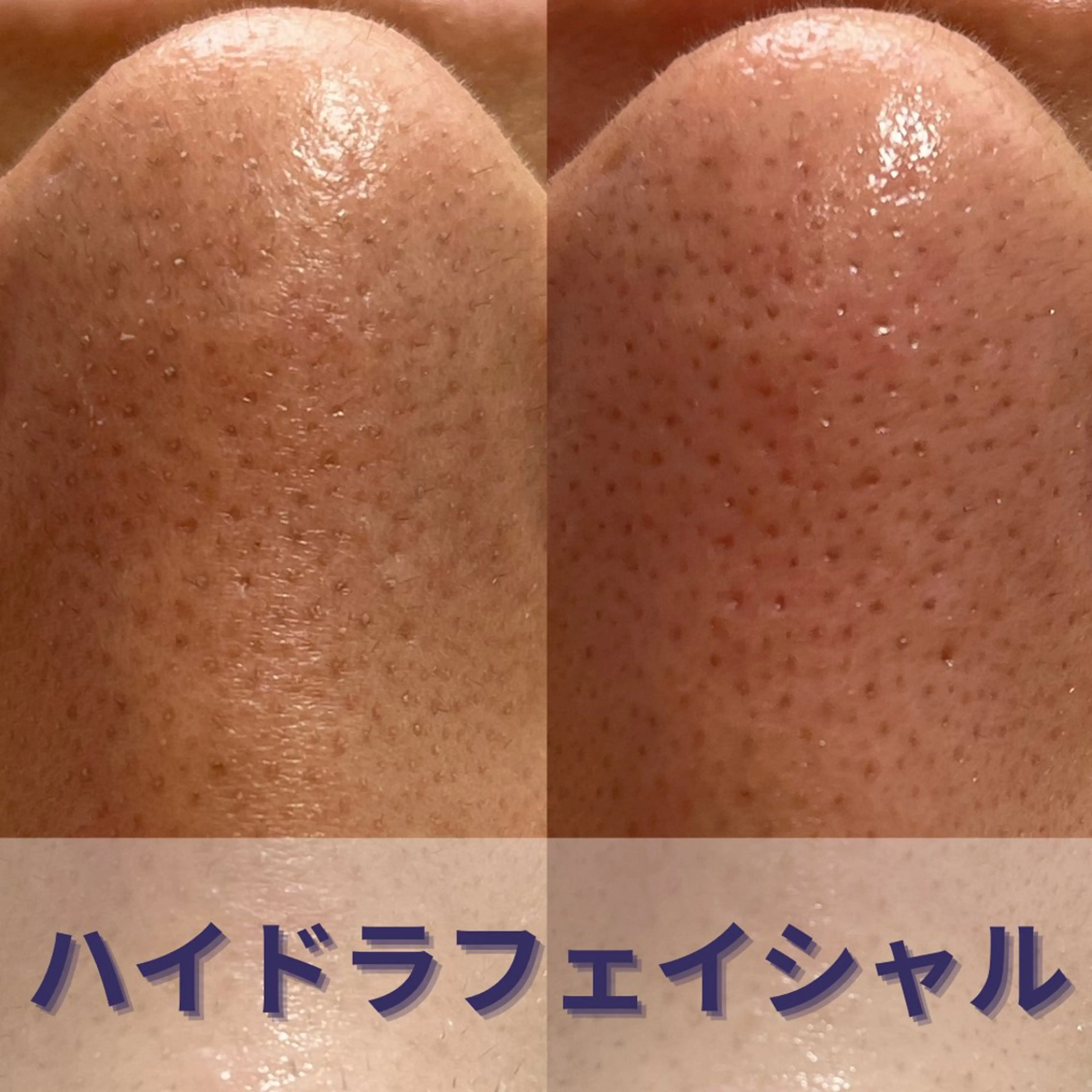 yokohama 🎀miaのマツエク・マツパデザイン