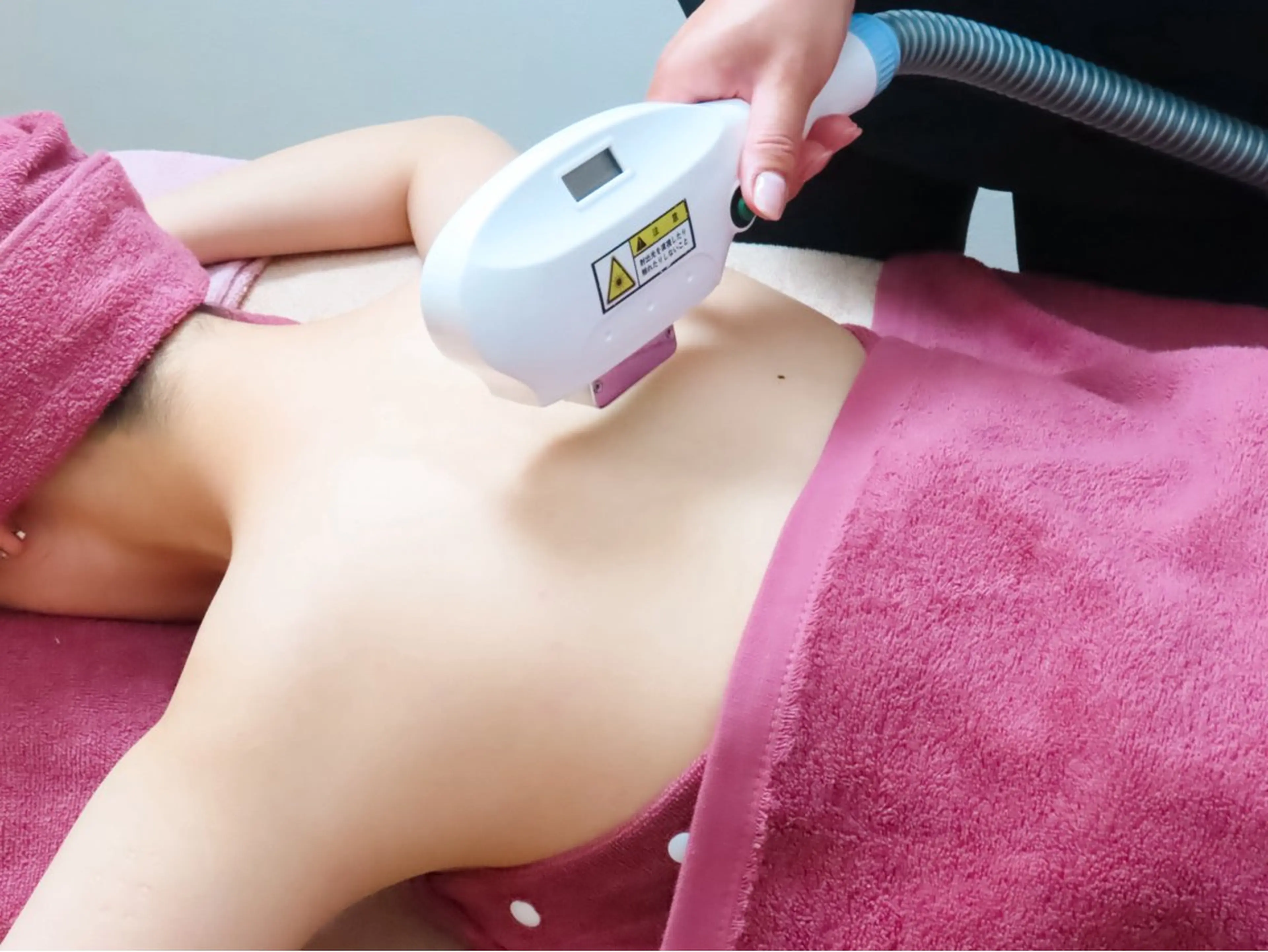 レディース背中・腰脱毛１回の写真