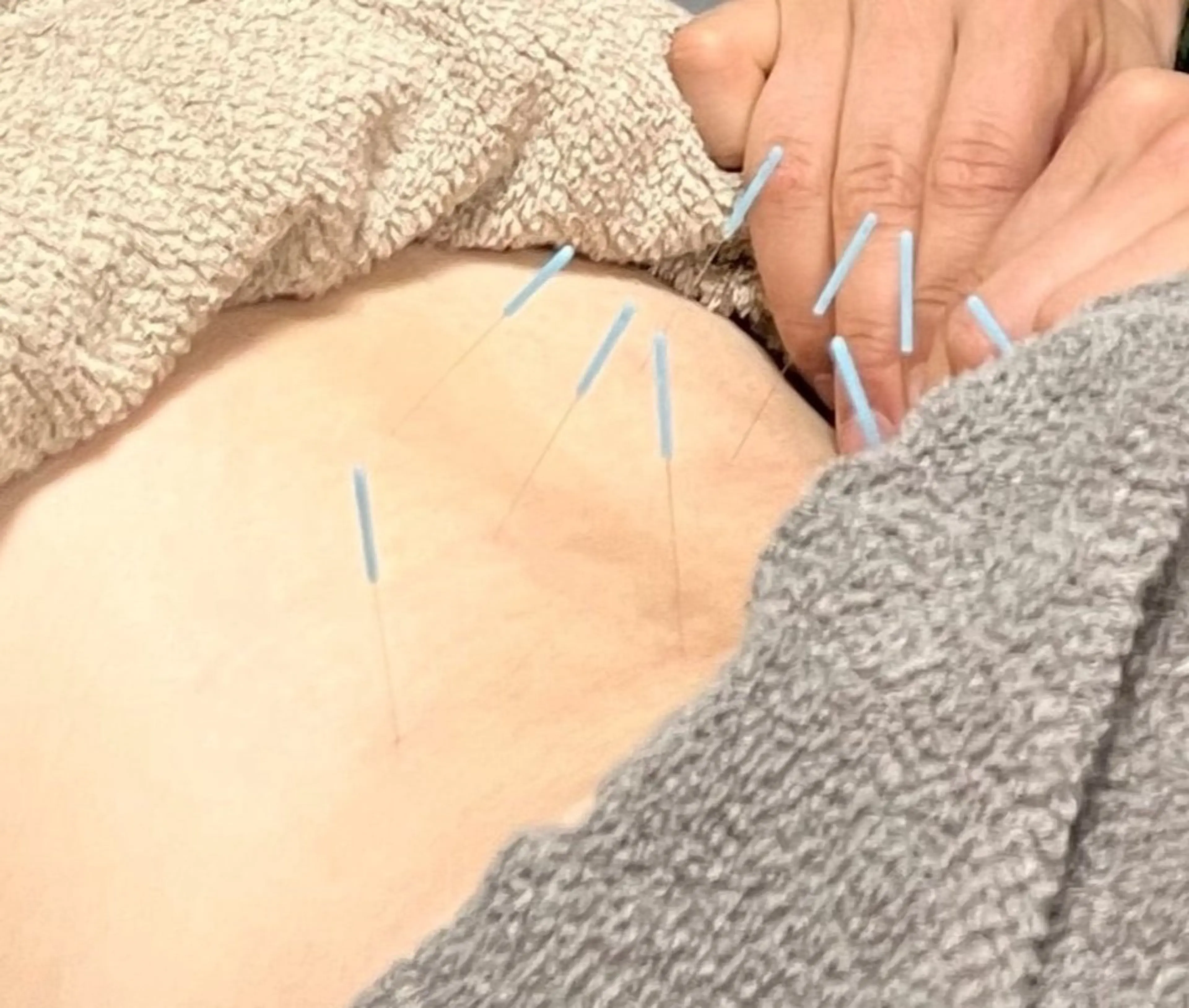 ことほぎ鍼灸整体　奈良登美ヶ丘院所属・ことほぎ鍼灸整体 奈良登美ヶ丘院　飯野のエステ・リラクイメージ