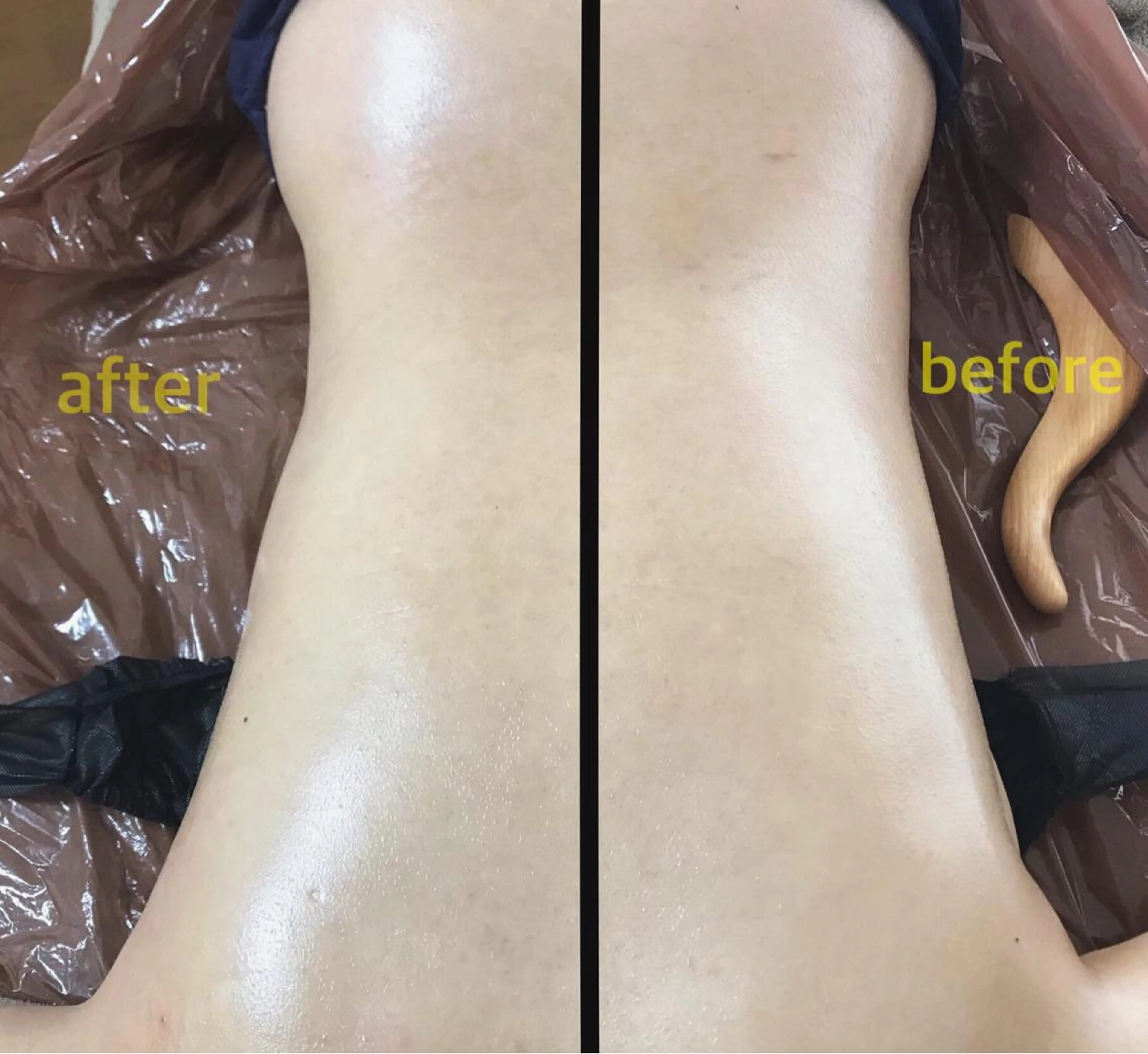 biloop所属・《痩身×疲労改善》 BILOOPのエステ・リラクイメージ